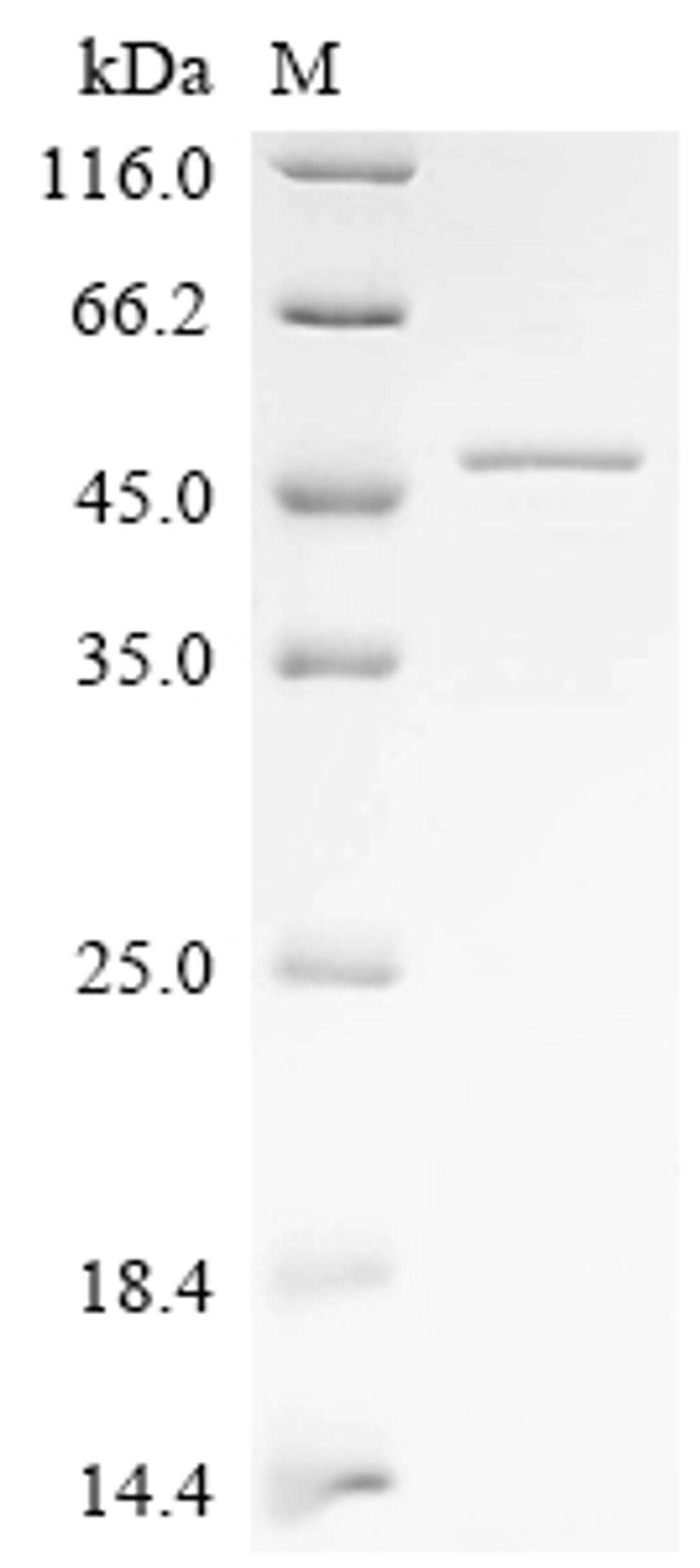 (Tris-Glycine gel) Discontinuous SDS-PAGE (reduced) with 5% enrichment gel and 15% separation gel.
