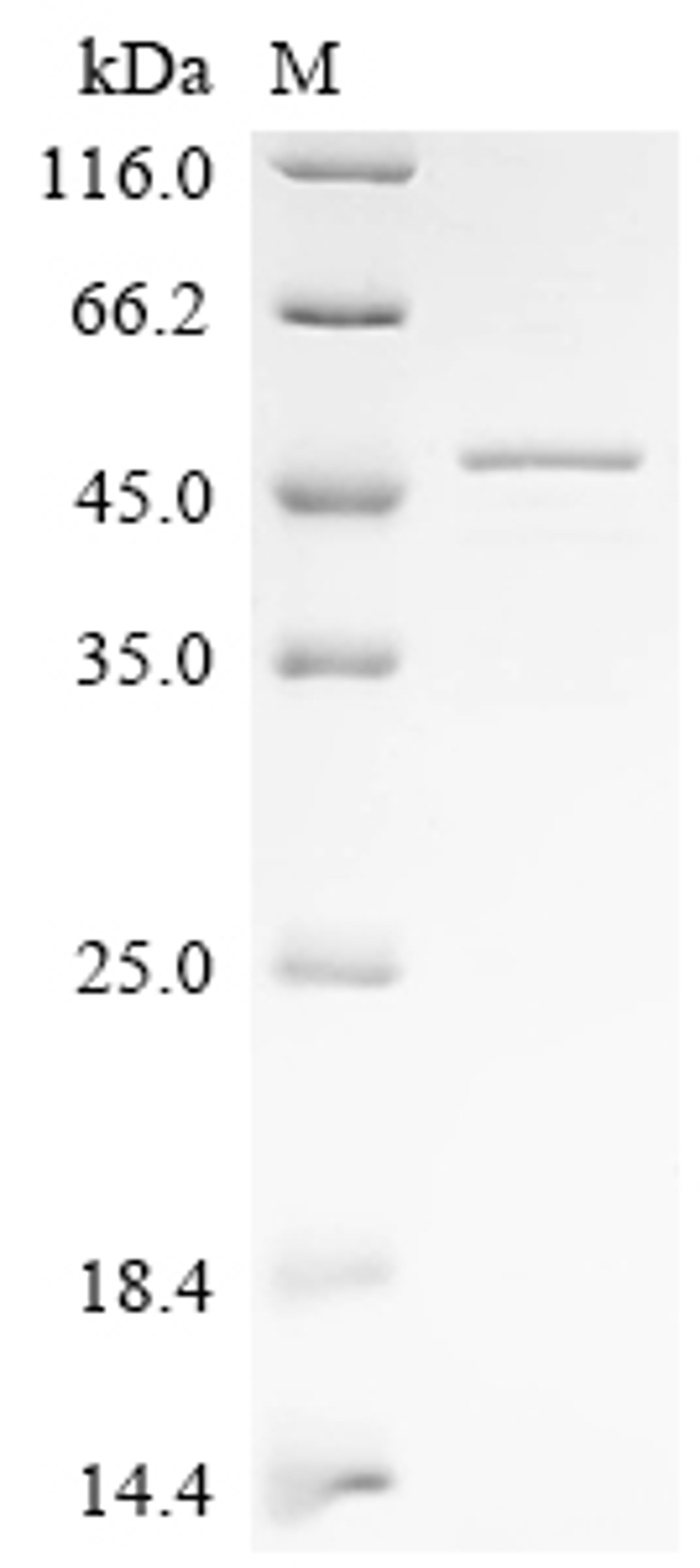 (Tris-Glycine gel) Discontinuous SDS-PAGE (reduced) with 5% enrichment gel and 15% separation gel.