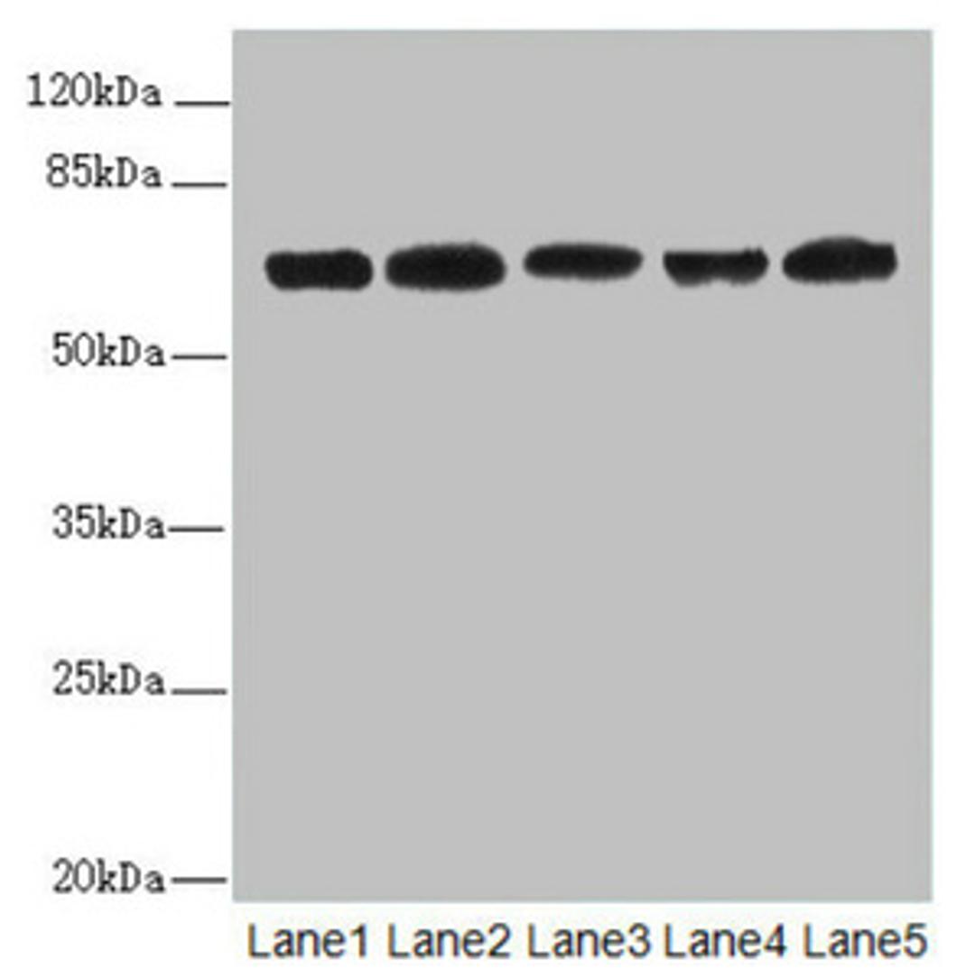Western blot. All lanes: ELF2 antibody at 2.27ug/ml. Lane 1: HL60 whole cell lysate. Lane 2: A549 whole cell lysate. Lane 3: MCF-7 whole cell lysate. Lane 4: Jurkat whole cell lysate. Lane 5: Hela whole cell lysate. Secondary. Goat polyclonal to rabbit IgG at 1/10000 dilution. Predicted band size: 64, 63, 57, 58, 55 kDa. Observed band size: 64, 50 kDa. 