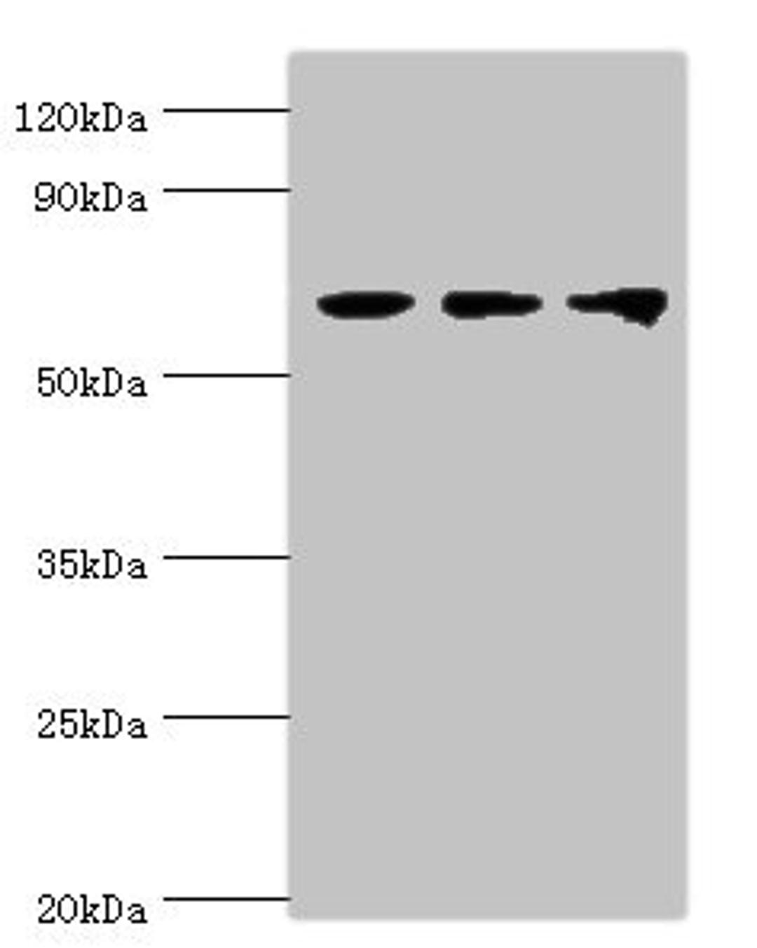 Western blot. All lanes: Probable ATP-dependent RNA helicase DDX5 antibody at 3ug/ml. Lane 1: NIH/3T3 whole cell lysate. Lane 2: Hela whole cell lysate. Lane 3: 293T whole cell lysate. Secondary. Goat polyclonal to rabbit IgG at 1/10000 dilution. Predicted band size: 70, 61 kDa. Observed band size: 70 kDa. 