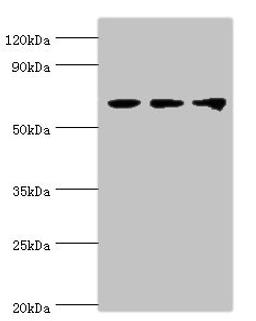 Western blot. All lanes: Probable ATP-dependent RNA helicase DDX5 antibody at 3ug/ml. Lane 1: NIH/3T3 whole cell lysate. Lane 2: Hela whole cell lysate. Lane 3: 293T whole cell lysate. Secondary. Goat polyclonal to rabbit IgG at 1/10000 dilution. Predicted band size: 70, 61 kDa. Observed band size: 70 kDa. 