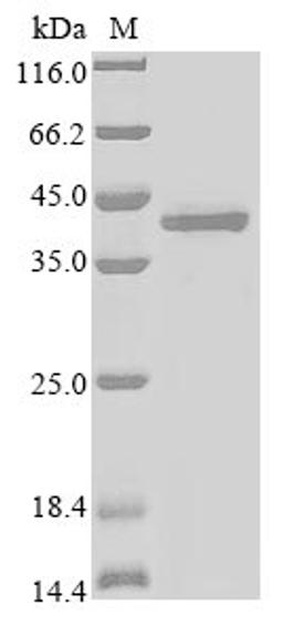 (Tris-Glycine gel) Discontinuous SDS-PAGE (reduced) with 5% enrichment gel and 15% separation gel.