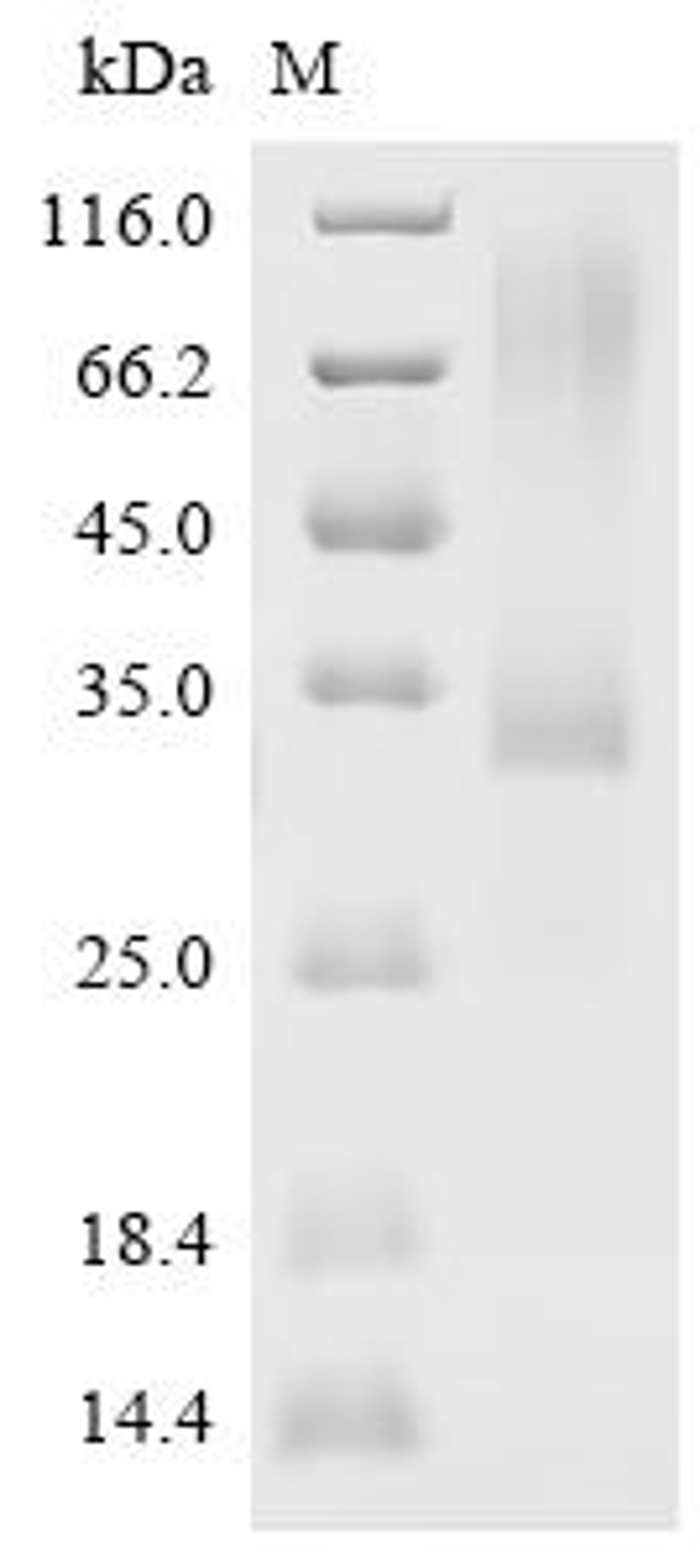 (Tris-Glycine gel) Discontinuous SDS-PAGE (reduced) with 5% enrichment gel and 15% separation gel.