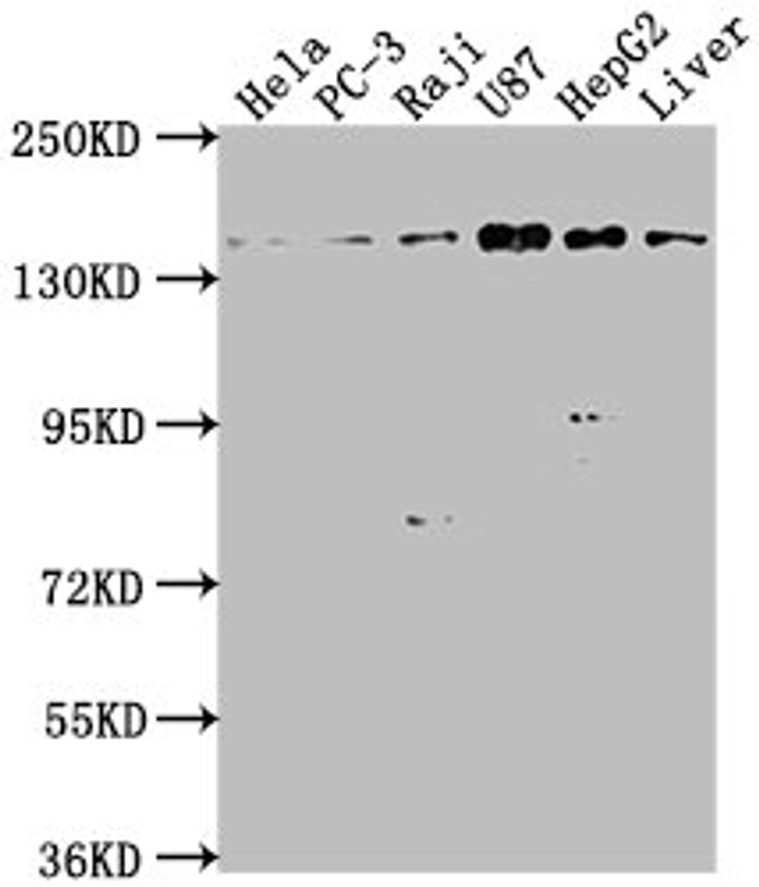 Western Blot. Positive WB detected in: Hela whole cell lysate, PC-3 whole cell lysate, Raji whole cell lysate, U87 whole cell lysate, HepG2 whole cell lysate, Mouse liver tissue. All lanes: MAP4K4 antibody at 1:1000. Secondary. Goat polyclonal to rabbit IgG at 1/50000 dilution. Predicted band size: 143, 139, 151, 134, 142, 146 kDa. Observed band size: 143 kDa. 