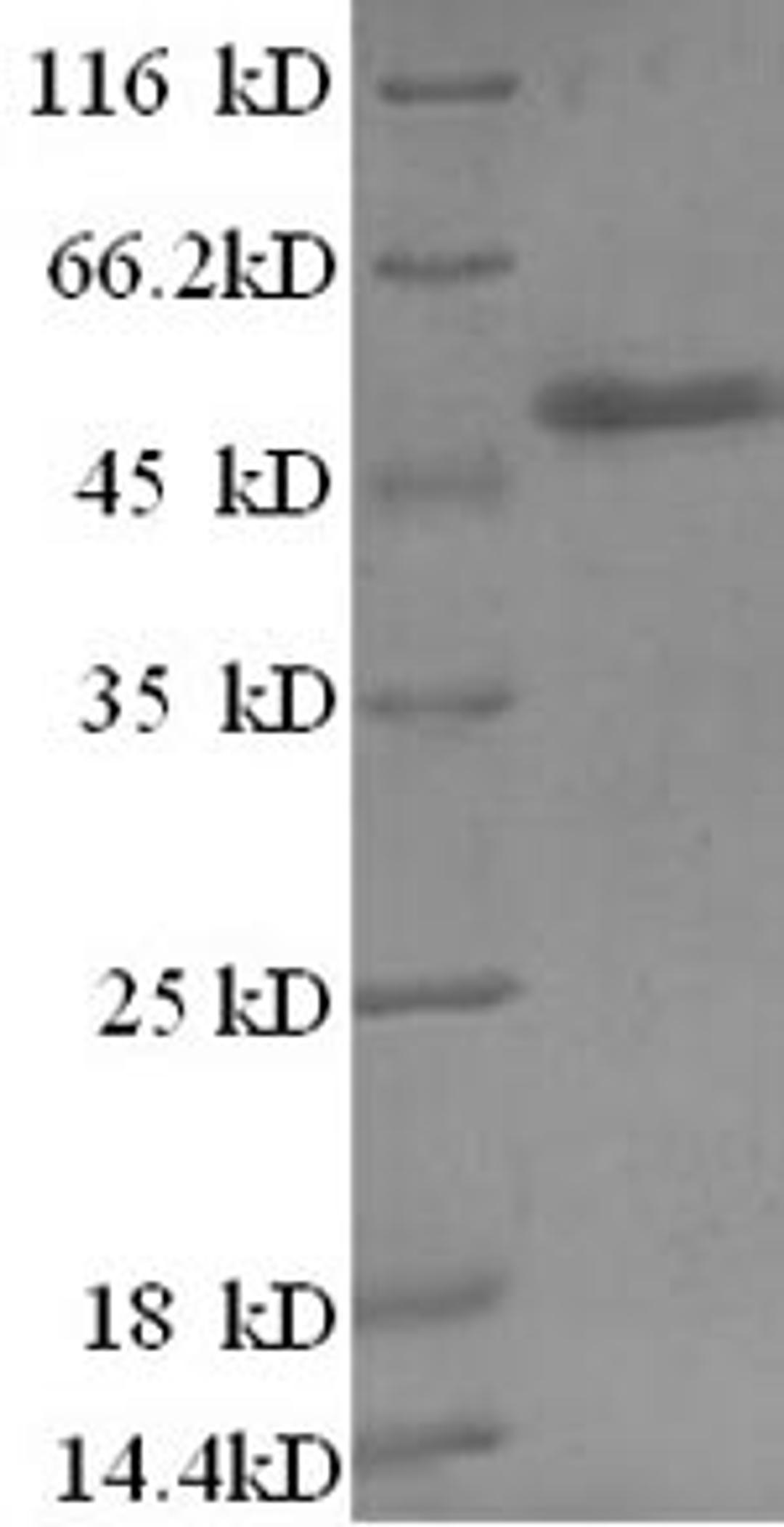 (Tris-Glycine gel) Discontinuous SDS-PAGE (reduced) with 5% enrichment gel and 15% separation gel.