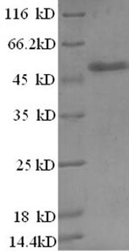 (Tris-Glycine gel) Discontinuous SDS-PAGE (reduced) with 5% enrichment gel and 15% separation gel.