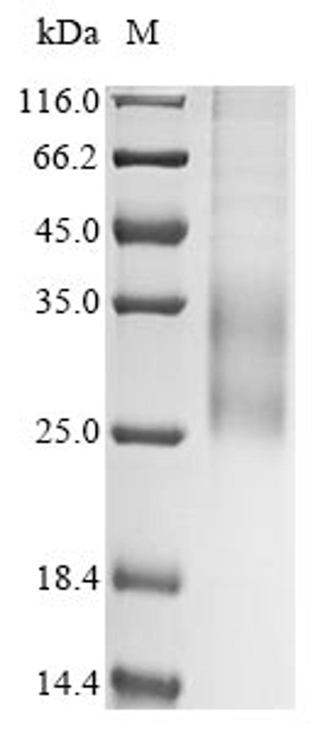 (Tris-Glycine gel) Discontinuous SDS-PAGE (reduced) with 5% enrichment gel and 15% separation gel.