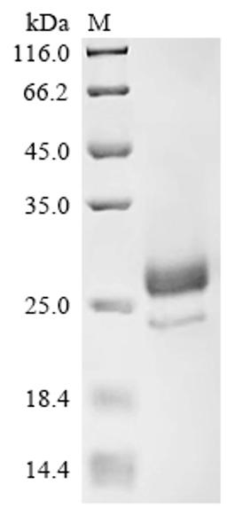 (Tris-Glycine gel) Discontinuous SDS-PAGE (reduced) with 5% enrichment gel and 15% separation gel.