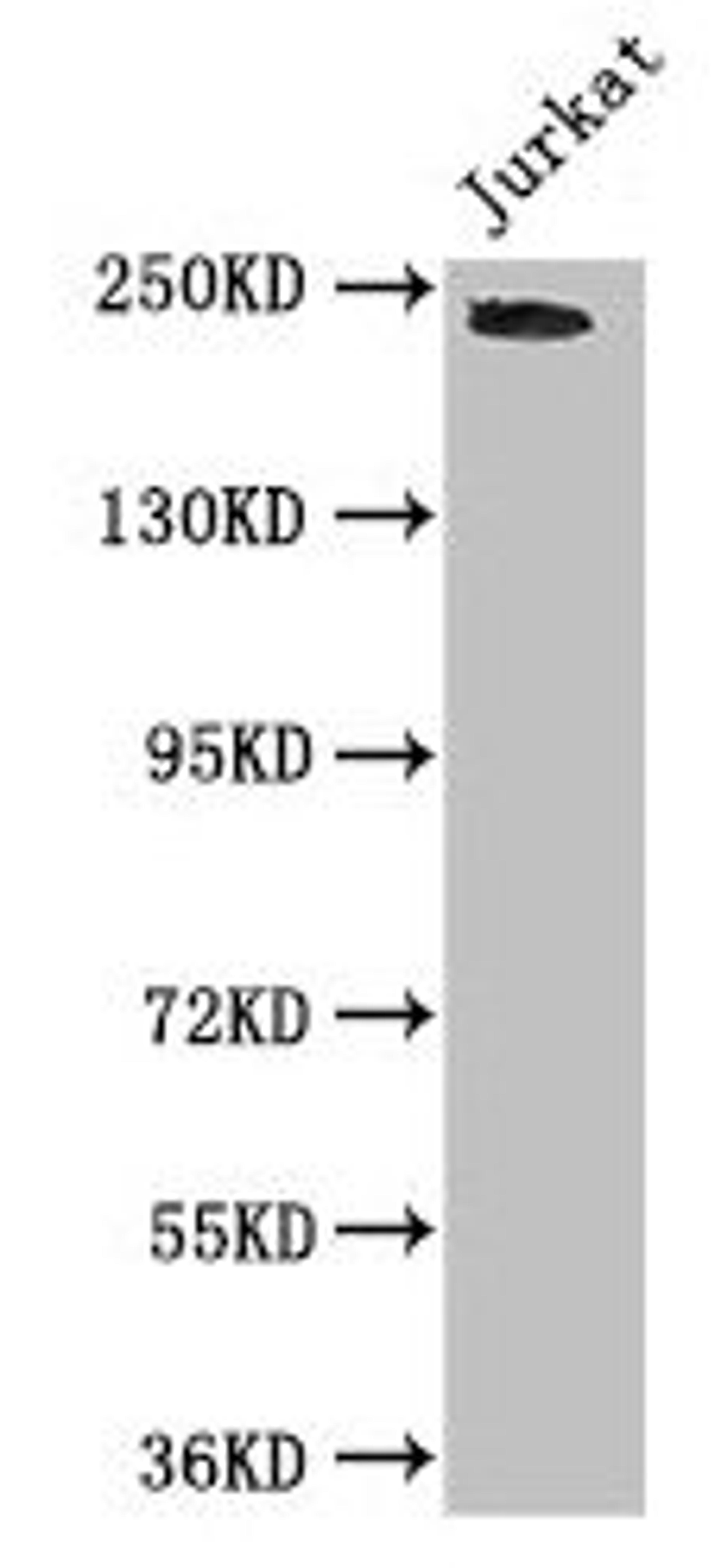 Western Blot. Positive WB detected in: Jurkat whole cell lysate. All lanes: DOCK7 antibody at 3µg/ml. Secondary. Goat polyclonal to rabbit IgG at 1/50000 dilution. Predicted band size: 243, 242, 239, 240, 73 kDa. Observed band size: 243 kDa
