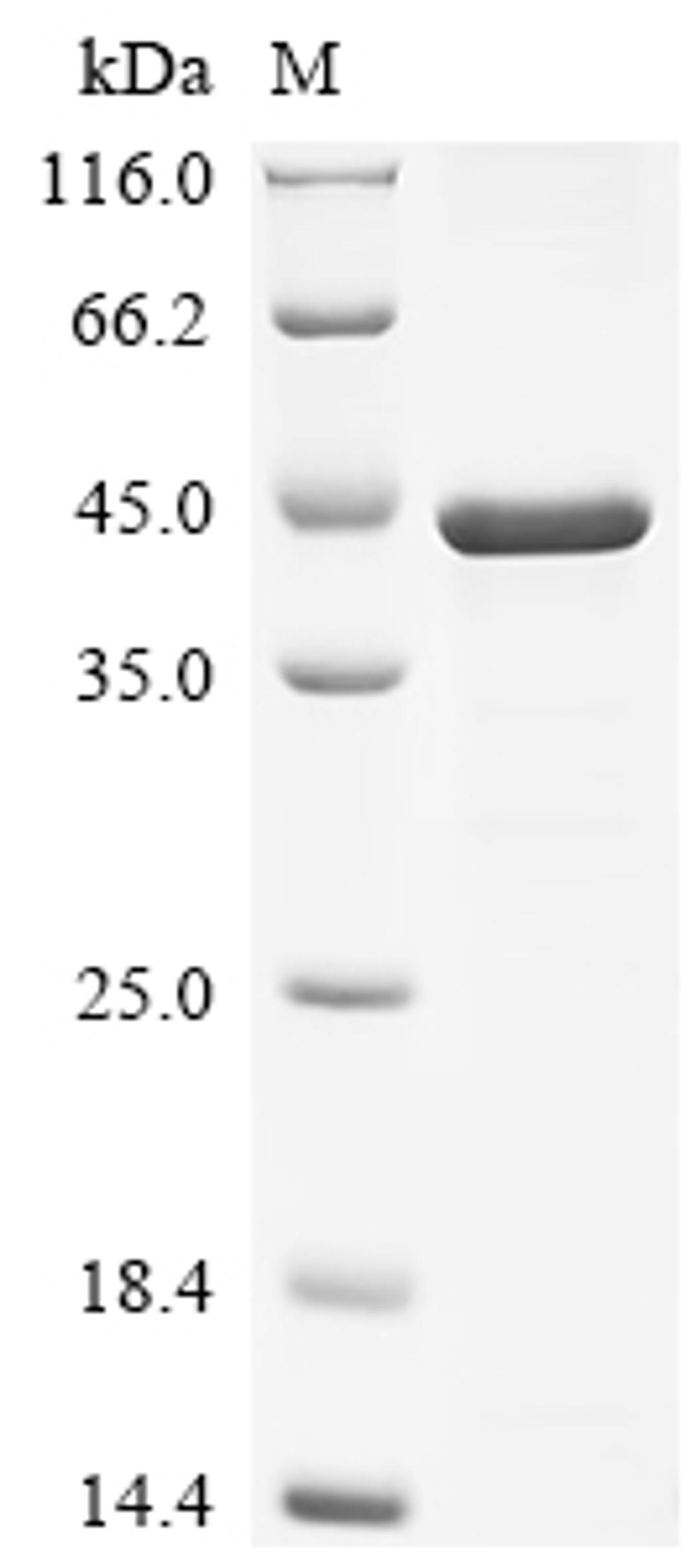(Tris-Glycine gel) Discontinuous SDS-PAGE (reduced) with 5% enrichment gel and 15% separation gel.