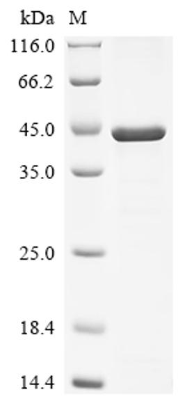 (Tris-Glycine gel) Discontinuous SDS-PAGE (reduced) with 5% enrichment gel and 15% separation gel.