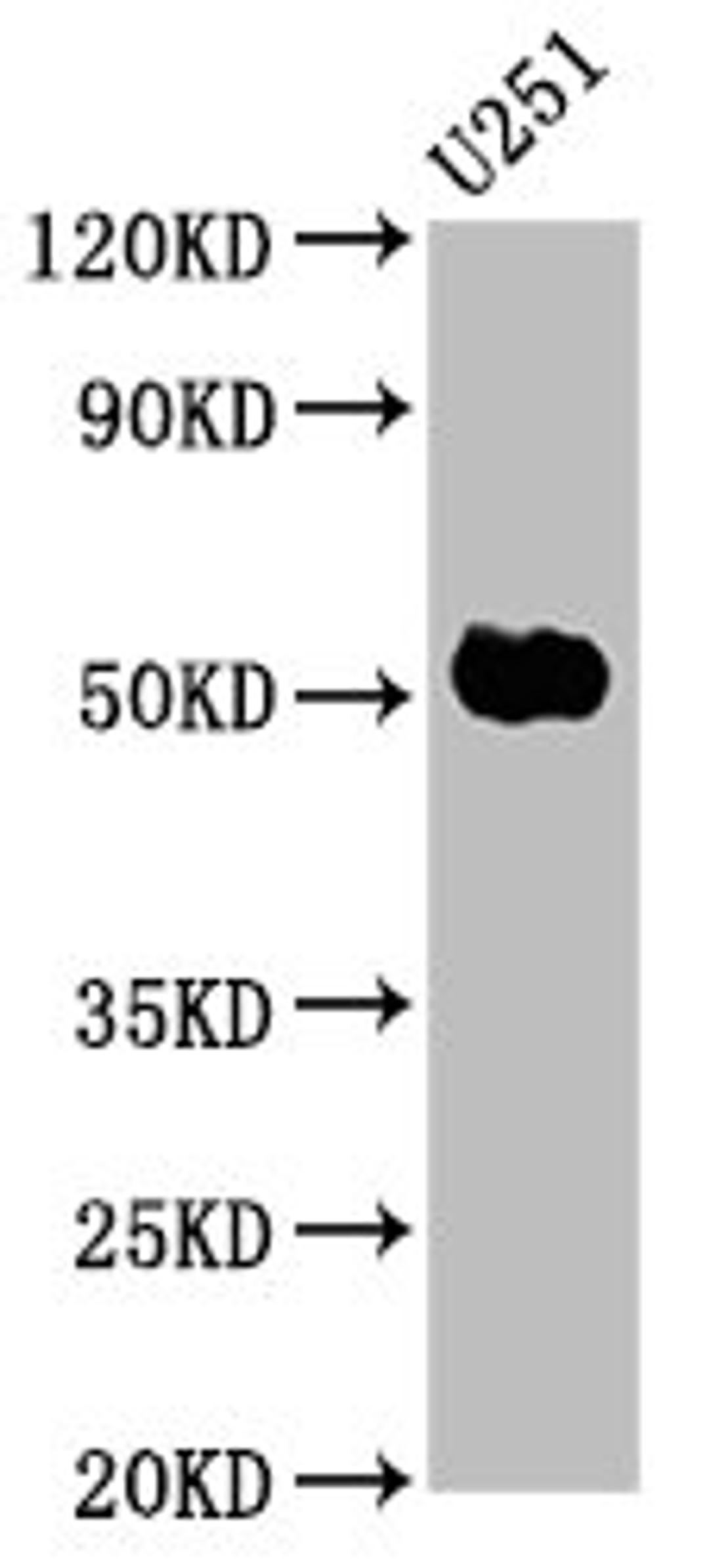 Western Blot. Positive WB detected in: U251 whole cell lysate. All lanes: FEZF1 antibody at 6µg/ml. Secondary. Goat polyclonal to rabbit IgG at 1/50000 dilution. Predicted band size: 53, 47, 52 kDa. Observed band size: 53 kDa