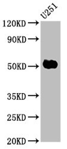 Western Blot. Positive WB detected in: U251 whole cell lysate. All lanes: FEZF1 antibody at 6µg/ml. Secondary. Goat polyclonal to rabbit IgG at 1/50000 dilution. Predicted band size: 53, 47, 52 kDa. Observed band size: 53 kDa