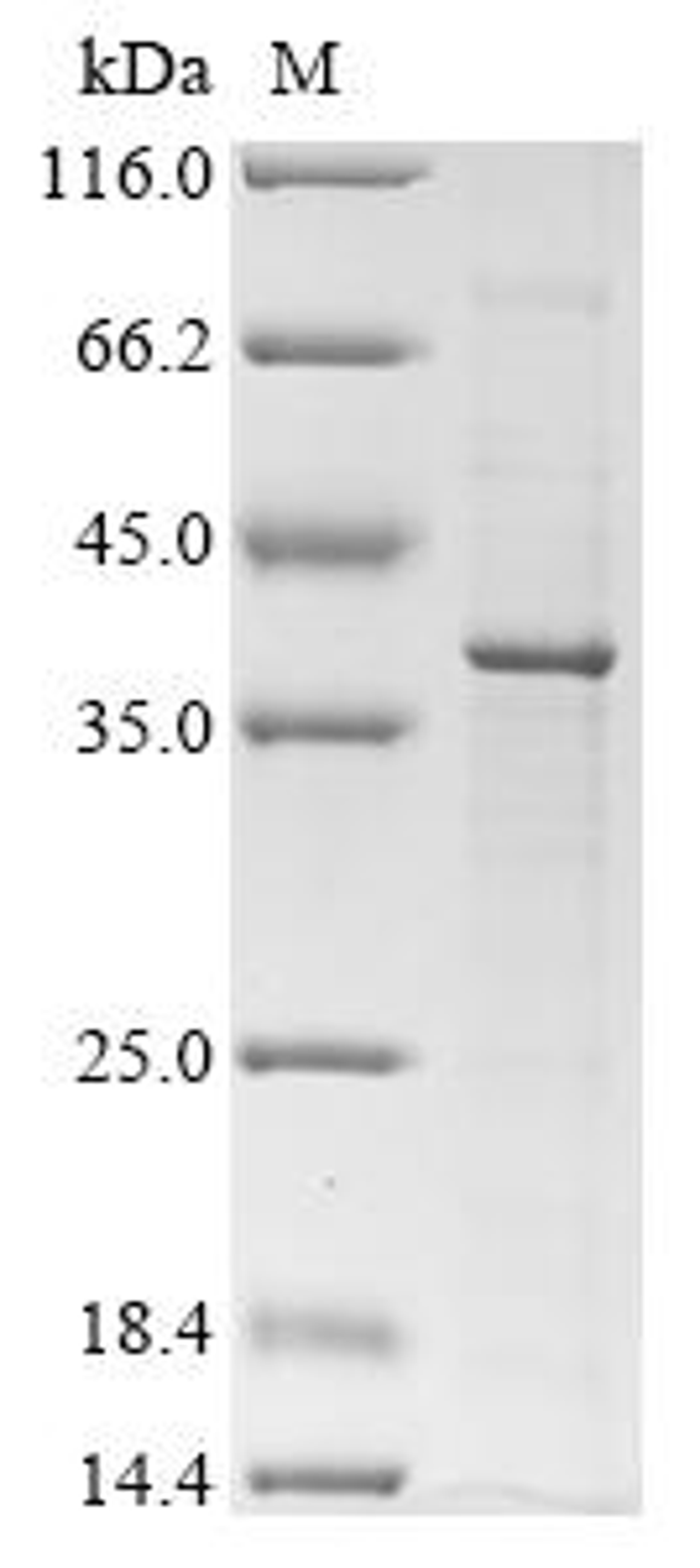 (Tris-Glycine gel) Discontinuous SDS-PAGE (reduced) with 5% enrichment gel and 15% separation gel.