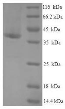 (Tris-Glycine gel) Discontinuous SDS-PAGE (reduced) with 5% enrichment gel and 15% separation gel.