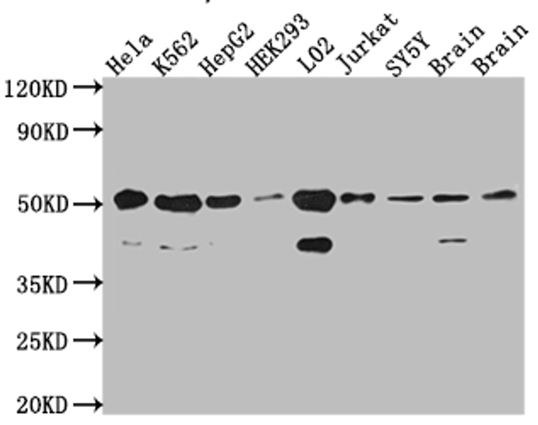 Western Blot. Positive WB detected in: Hela whole cell lysate, K562 whole cell lysate, HepG2 whole cell lysate, HEK293 whole cell lysate, L02 whole cell lysate, Jurkat whole cell lysate, SH-SY5Y whole cell lysate, Mouse Brain whole cell lysate, Rat Brain cell lysate. All lanes: RbAp48 antibody at 1:1000. Secondary. Goat polyclonal to rabbit IgG at 1/50000 dilution. Predicted band size: 48, 48, 47, 44 kDa. Observed band size: 53, 40 kDa.