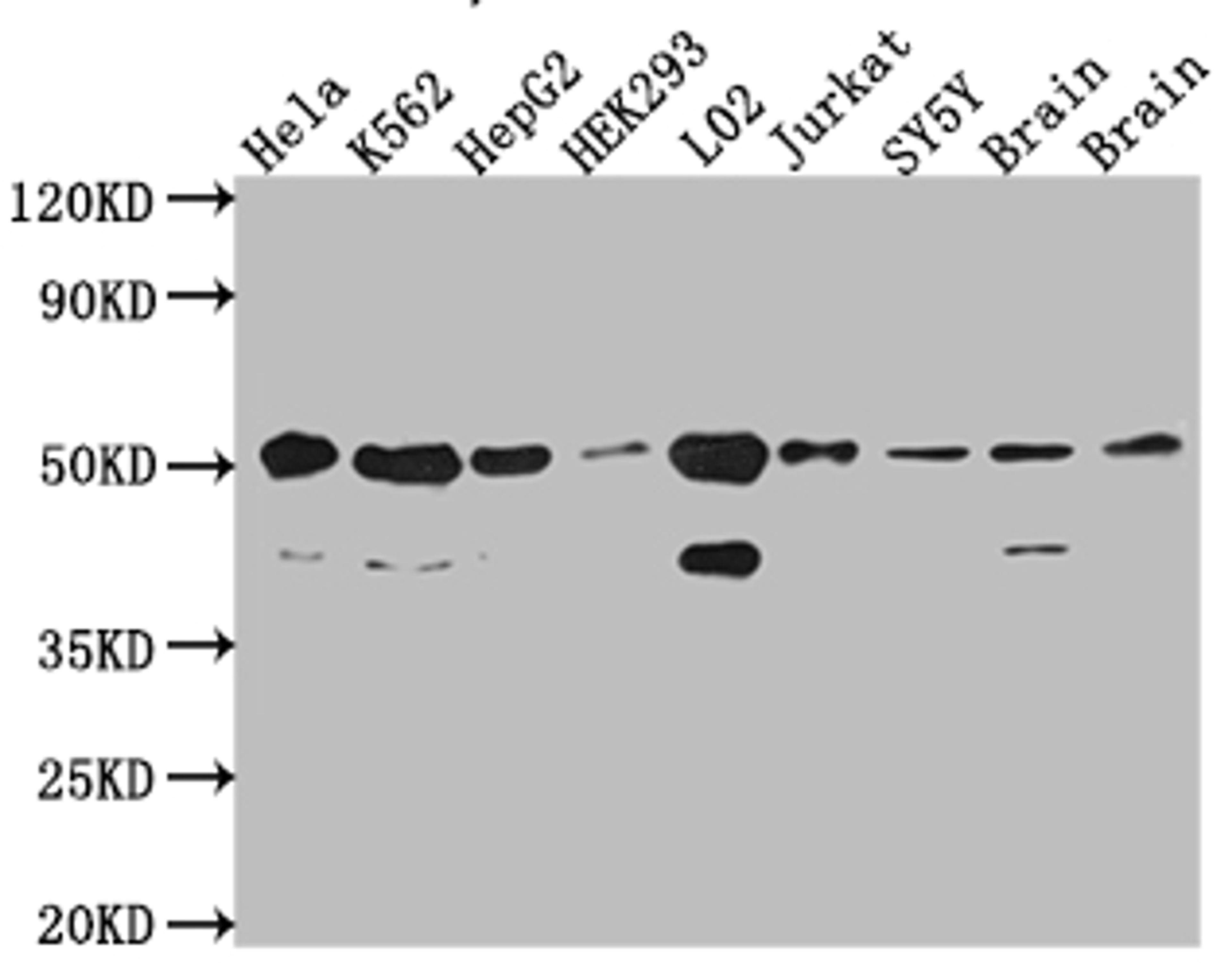 Western Blot. Positive WB detected in: Hela whole cell lysate, K562 whole cell lysate, HepG2 whole cell lysate, HEK293 whole cell lysate, L02 whole cell lysate, Jurkat whole cell lysate, SH-SY5Y whole cell lysate, Mouse Brain whole cell lysate, Rat Brain cell lysate. All lanes: RbAp48 antibody at 1:1000. Secondary. Goat polyclonal to rabbit IgG at 1/50000 dilution. Predicted band size: 48, 48, 47, 44 kDa. Observed band size: 53, 40 kDa.
