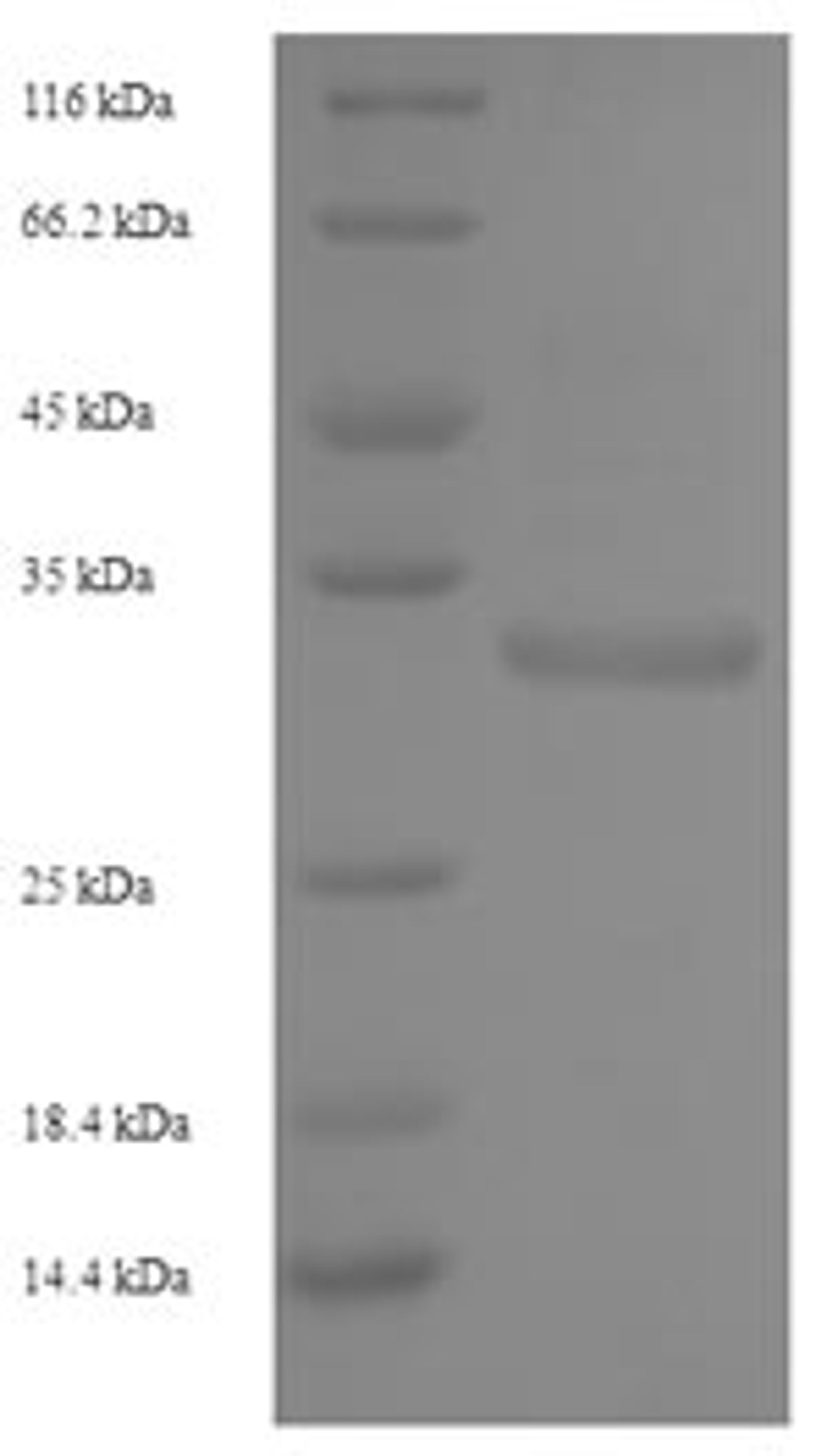 (Tris-Glycine gel) Discontinuous SDS-PAGE (reduced) with 5% enrichment gel and 15% separation gel.