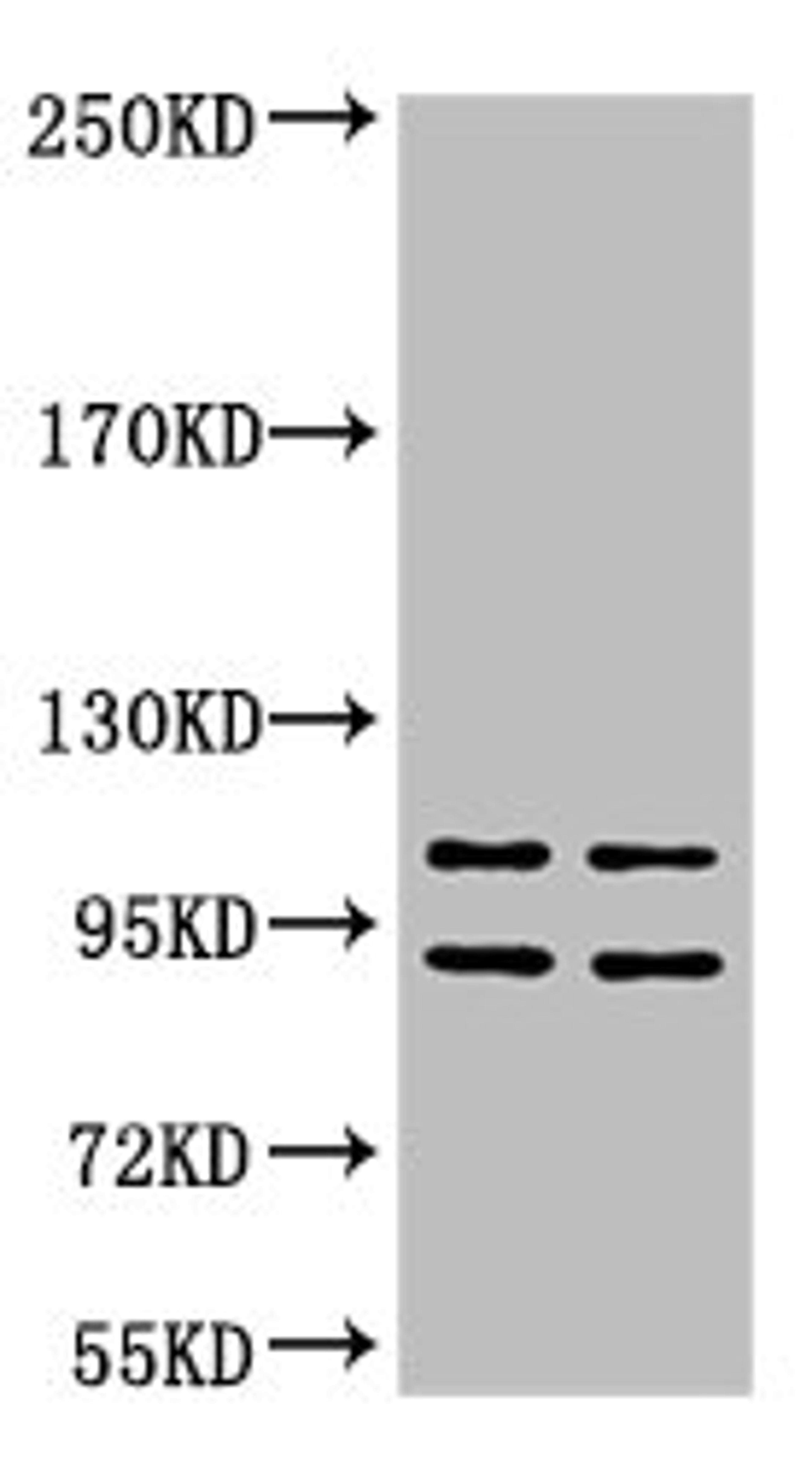 Western blot analysis of 1) Hela, 2) HepG2, diluted at 1:2000