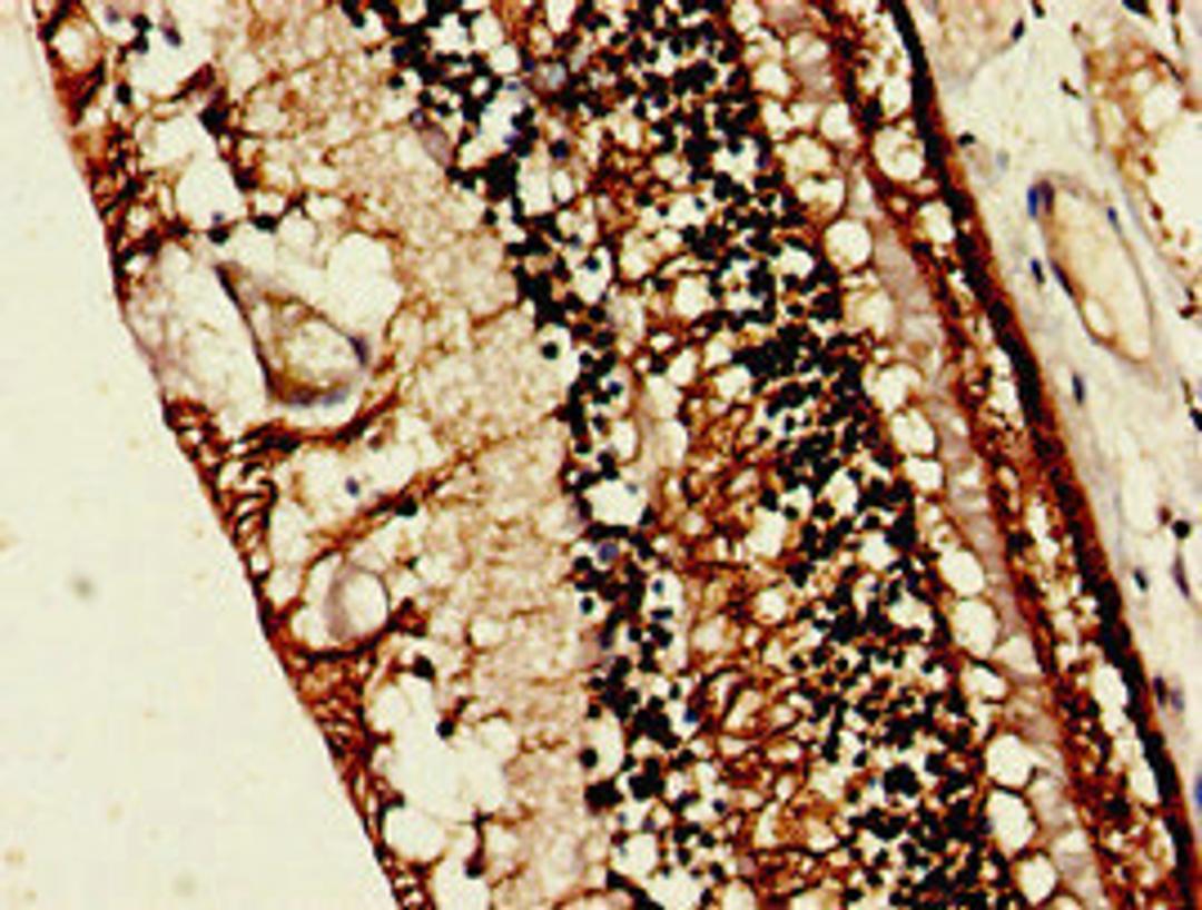 Immunohistochemistry of paraffin-embedded human eye tissue using CSB-PA019743LA01HU at dilution of 1:100