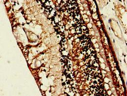 Immunohistochemistry of paraffin-embedded human eye tissue using CSB-PA019743LA01HU at dilution of 1:100
