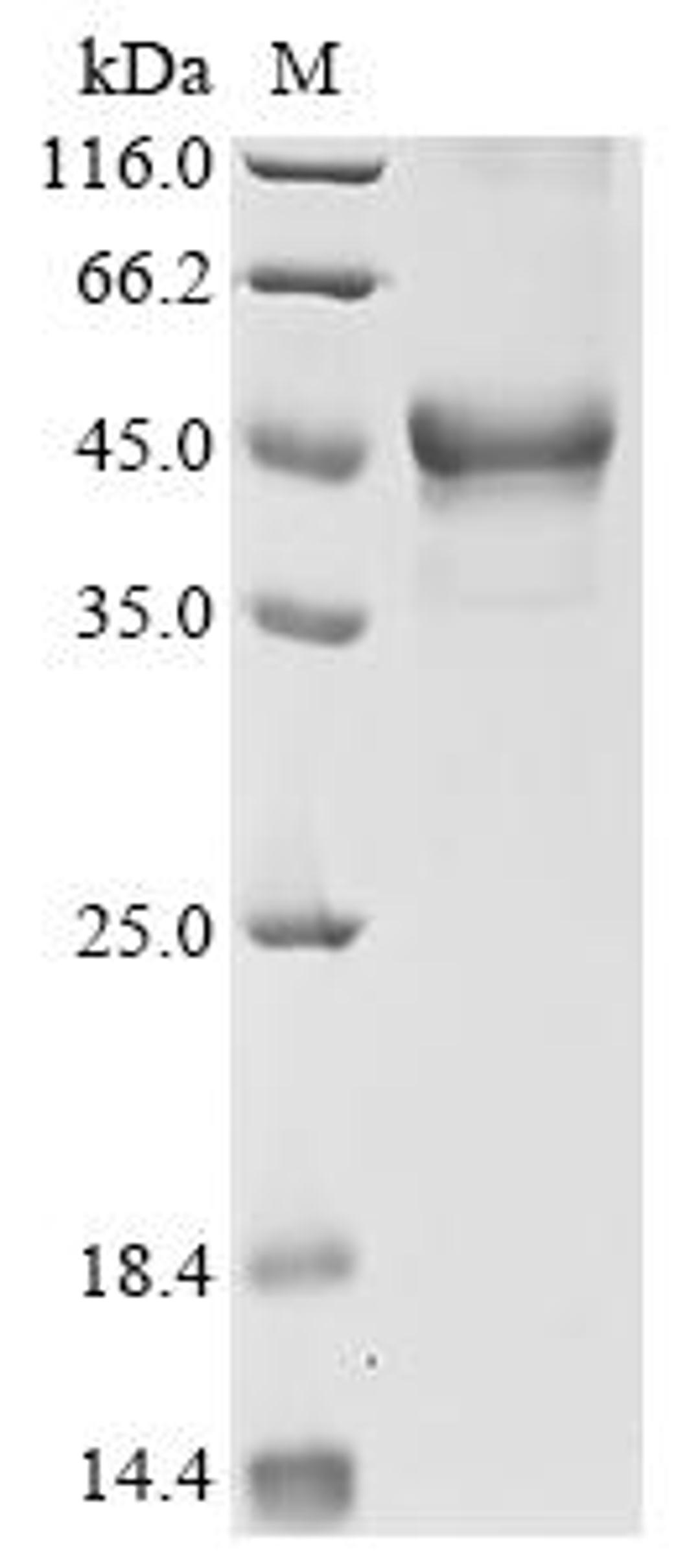 (Tris-Glycine gel) Discontinuous SDS-PAGE (reduced) with 5% enrichment gel and 15% separation gel.