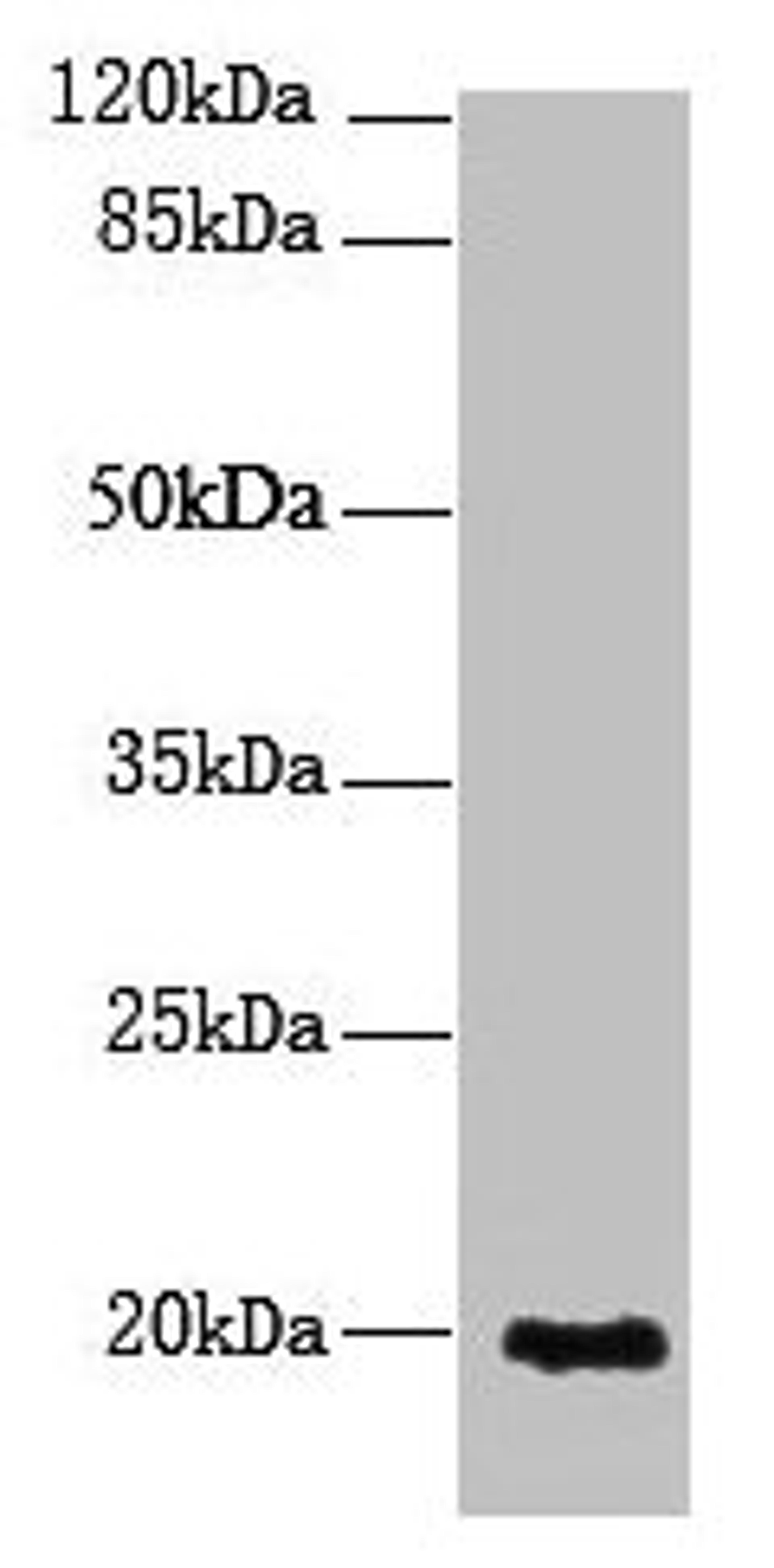 Western blot. All lanes: NUDT11 antibody at 2µg/ml + U251 whole cell lysate. Secondary. Goat polyclonal to rabbit IgG at 1/10000 dilution. Predicted band size: 19 kDa. Observed band size: 19 kDa