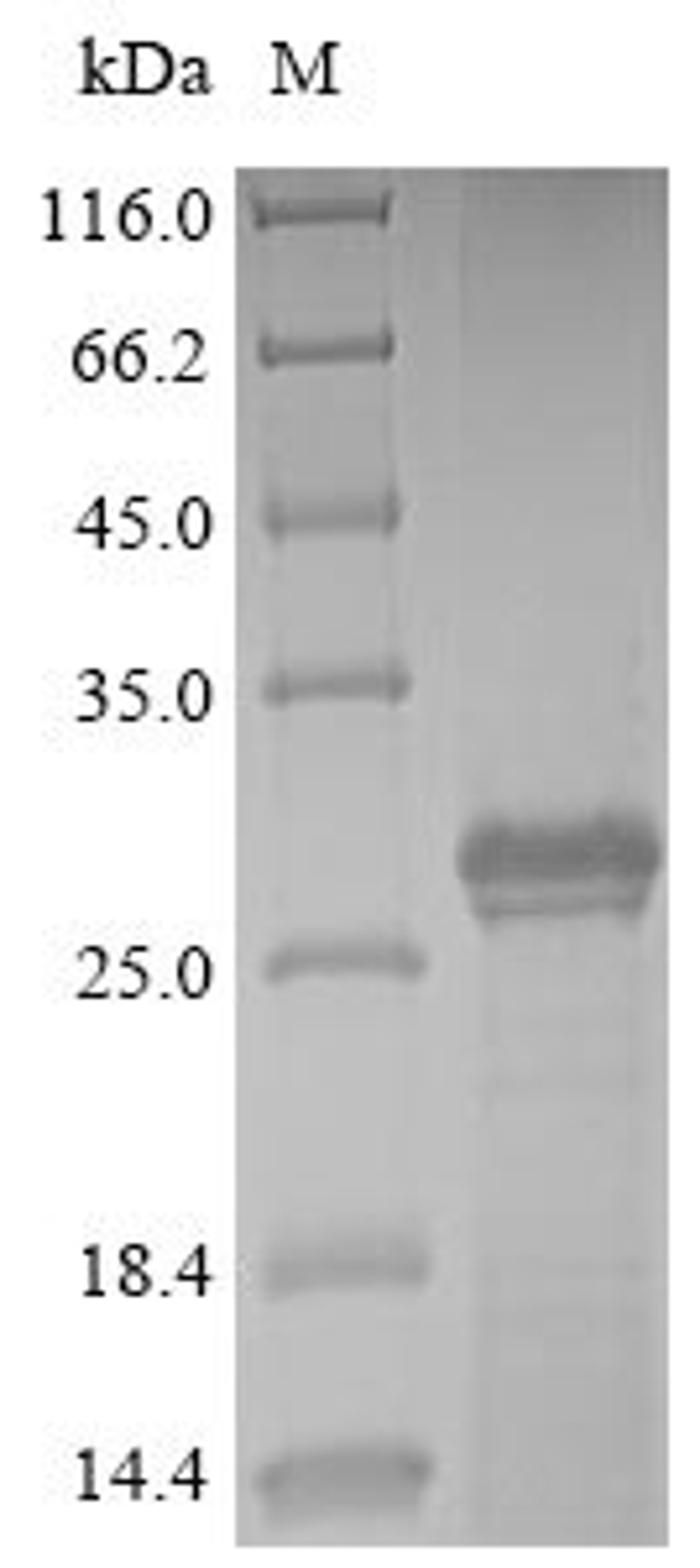 (Tris-Glycine gel) Discontinuous SDS-PAGE (reduced) with 5% enrichment gel and 15% separation gel.