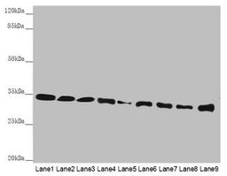 Western blot. All lanes: HADH antibody at 2.38µg/ml. Lane 1: Mouse heart tissue. Lane 2: Mouse liver tissue. Lane 3: Mouse kidney tissue. Lane 4: Mouse skeletal muscle tissue. Lane 5: NIH/3T3 whole cell lysate. Lane 6: Hela whole cell lysate. Lane 7: 293T whole cell lysate. Lane 8: A431 whole cell lysate. Lane 9: Jurkat whole cell lysate. Secondary. Goat polyclonal to rabbit IgG at 1/10000 dilution. Predicted band size: 35, 43, 37 kDa. Observed band size: 35 kDa