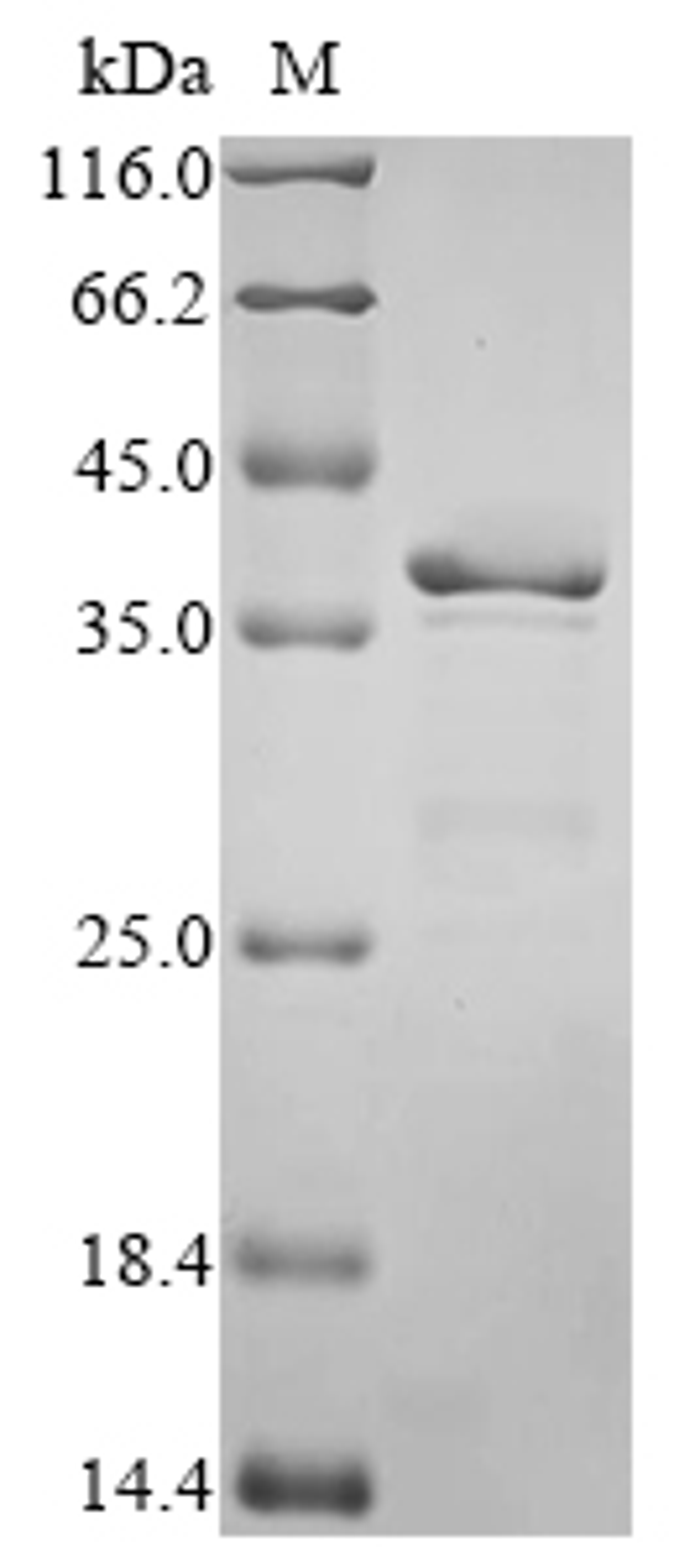 (Tris-Glycine gel) Discontinuous SDS-PAGE (reduced) with 5% enrichment gel and 15% separation gel.