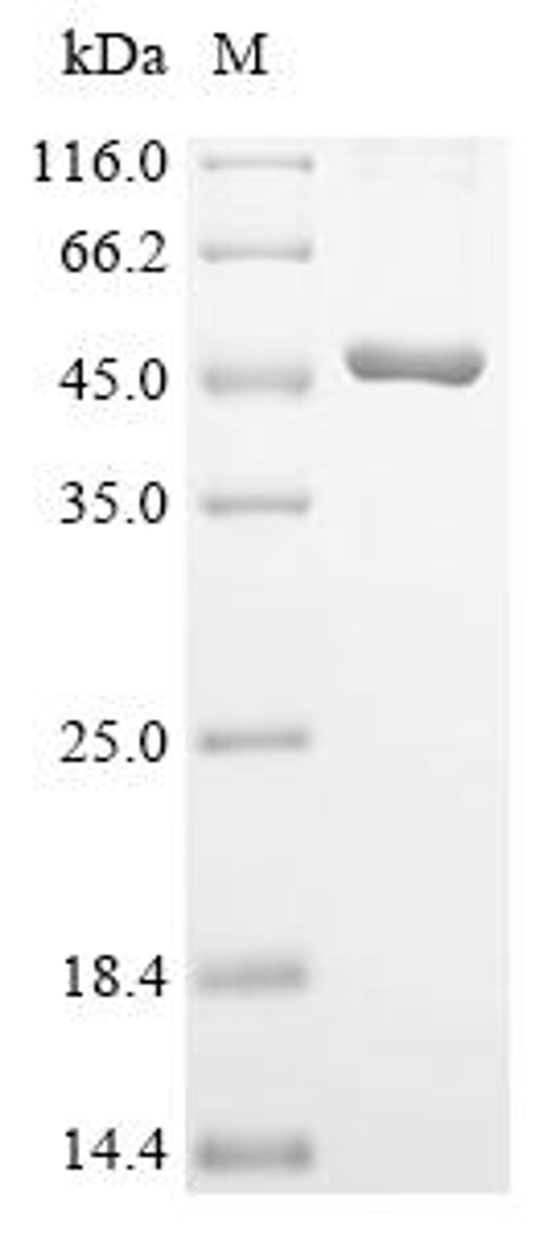 (Tris-Glycine gel) Discontinuous SDS-PAGE (reduced) with 5% enrichment gel and 15% separation gel.