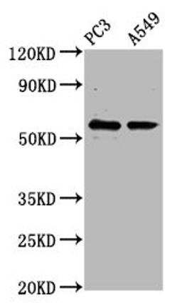 Western Blot. Positive WB detected in: PC-3 whole cell lysate, A549 whole cell lysate. All lanes: CYP1B1 antibody at 6.62ug/ml. Secondary. Goat polyclonal to rabbit IgG at 1/50000 dilution. Predicted band size: 61 kDa. Observed band size: 61 kDa. 