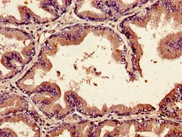 Immunohistochemistry of paraffin-embedded human prostate tissue using CSB-PA09419A0Rb at dilution of 1:100