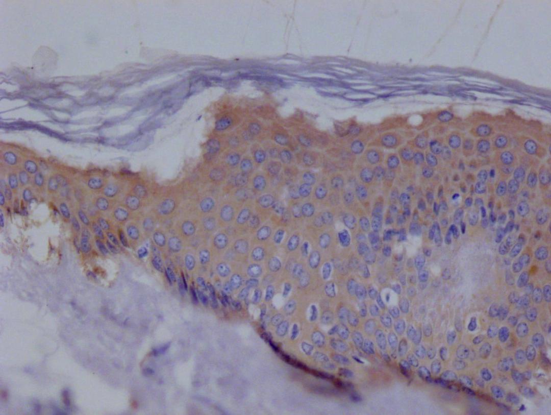 IHC image of CSB-RA194531A0HU diluted at 1:100 and staining in paraffin-embedded human skin tissue performed on a Leica BondTM system. After dewaxing and hydration, antigen retrieval was mediated by high pressure in a citrate buffer (pH 6.0). Section was blocked with 10% normal goat serum 30min at RT. Then primary antibody (1% BSA) was incubated at 4°C overnight. The primary is detected by a Goat anti-rabbit polymer IgG labeled by HRP and visualized using 0.05% DAB.