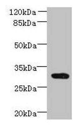 Western blot. All lanes: CCDC127 antibody at 6µg/ml + Mouse kidney tissue. Secondary. Goat polyclonal to rabbit IgG at 1/10000 dilution. Predicted band size: 31 kDa. Observed band size: 31 kDa