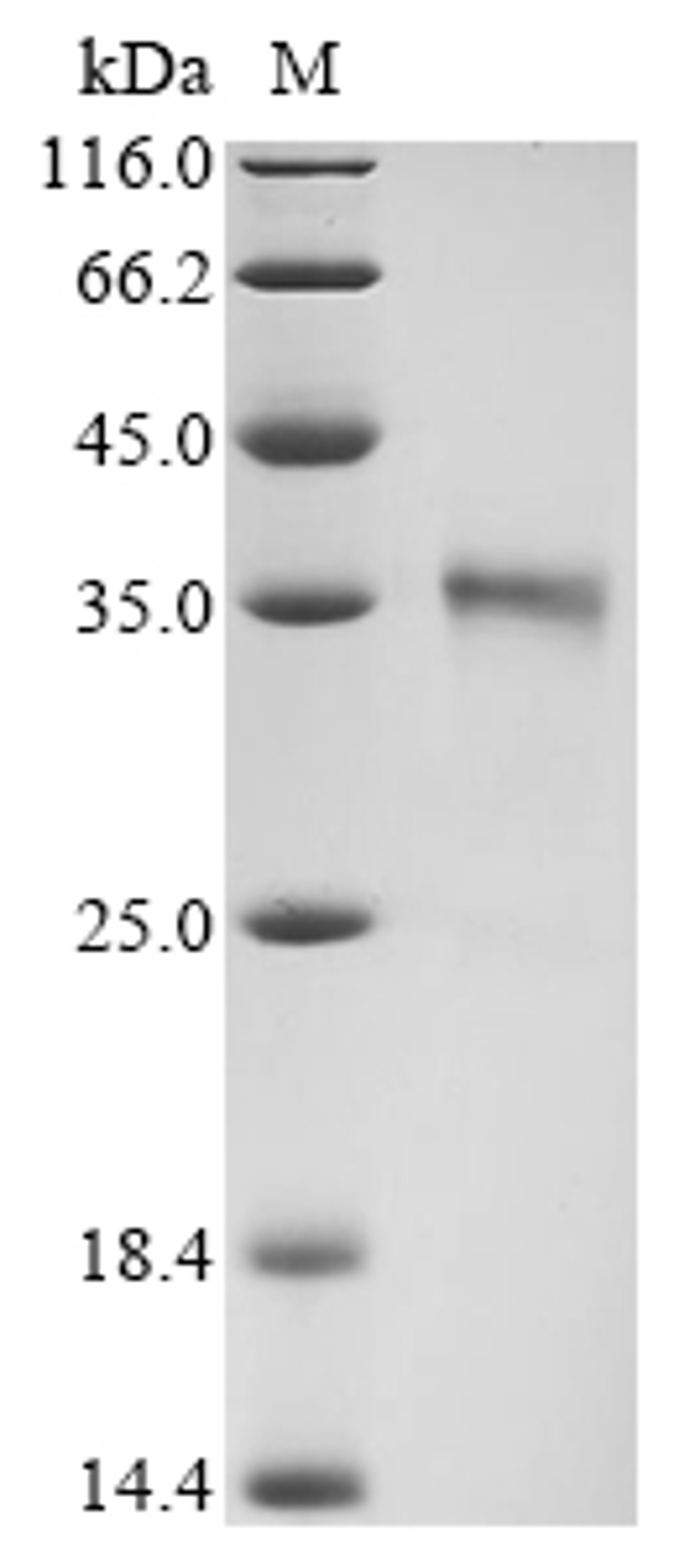 (Tris-Glycine gel) Discontinuous SDS-PAGE (reduced) with 5% enrichment gel and 15% separation gel.