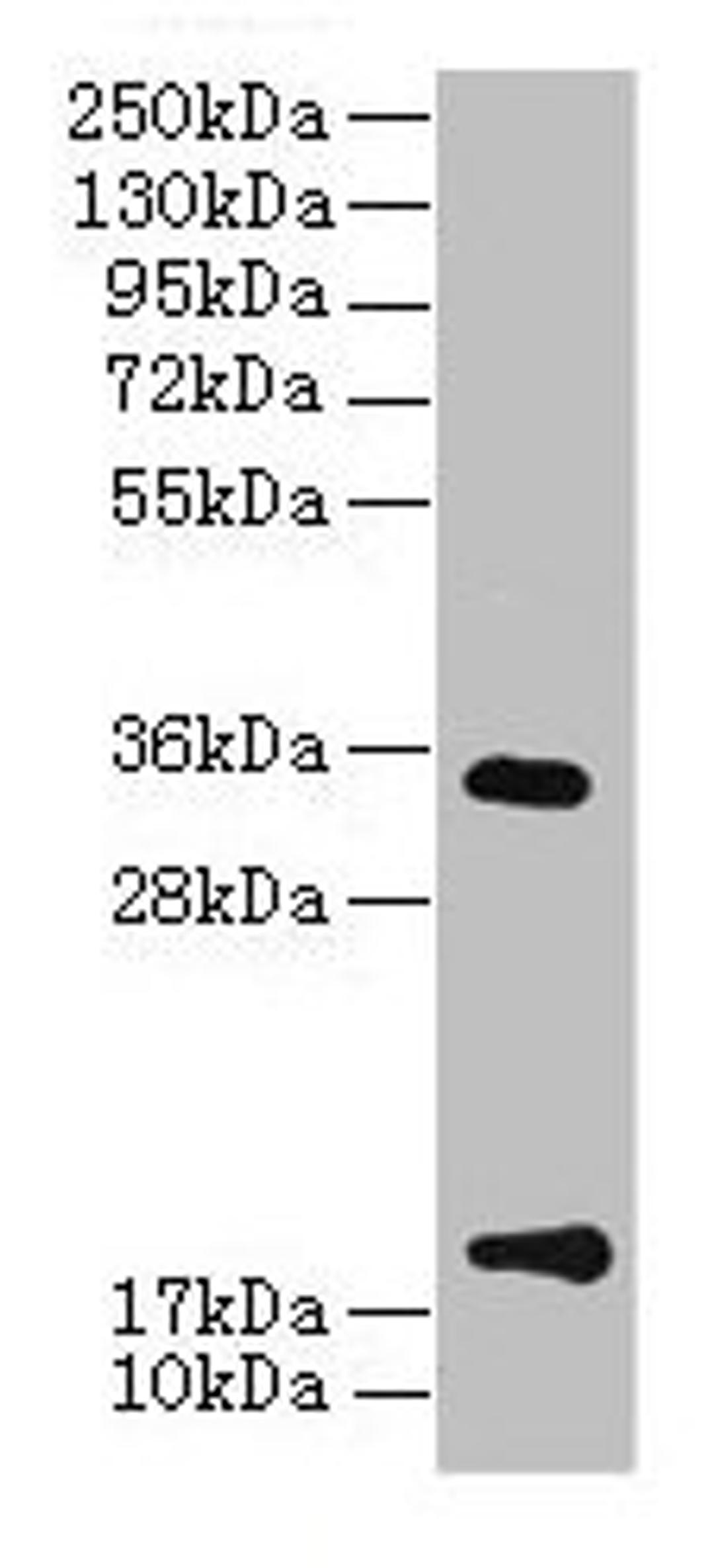 Western Blot. All lanes: TMEM91 antibody at 16µg/ml + A549 whole cell lysate. Secondary. Goat polyclonal to rabbit IgG at 1/10000 dilution. Predicted band size: 19, 16, 14, 15 kDa. Observed band size: 19, 34 kDa