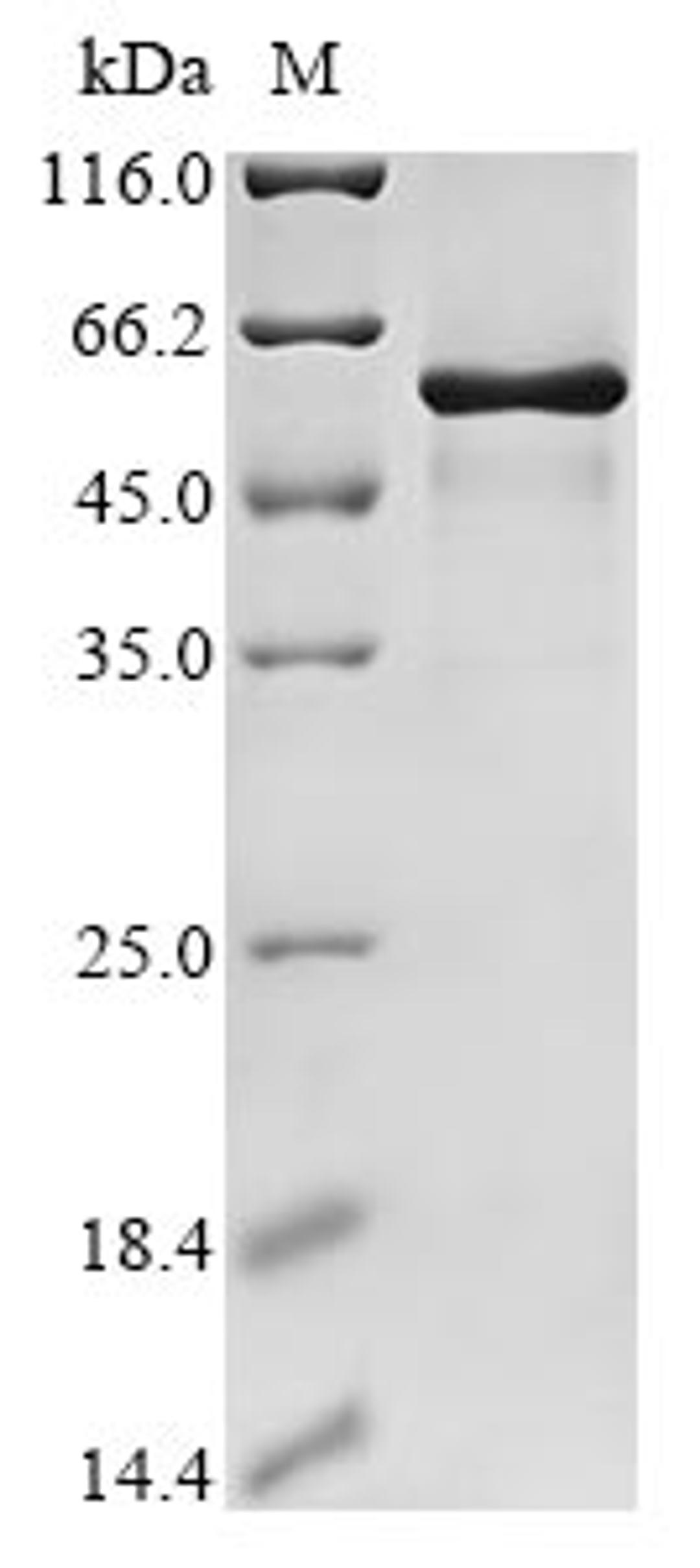 (Tris-Glycine gel) Discontinuous SDS-PAGE (reduced) with 5% enrichment gel and 15% separation gel.