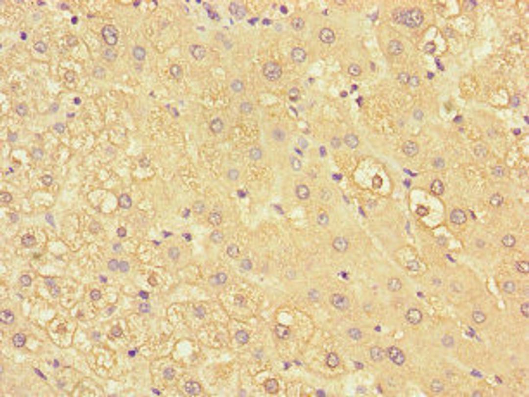 Immunohistochemistry of paraffin-embedded human liver tissue using CSB-PA012354LA01HU at dilution of 1:100