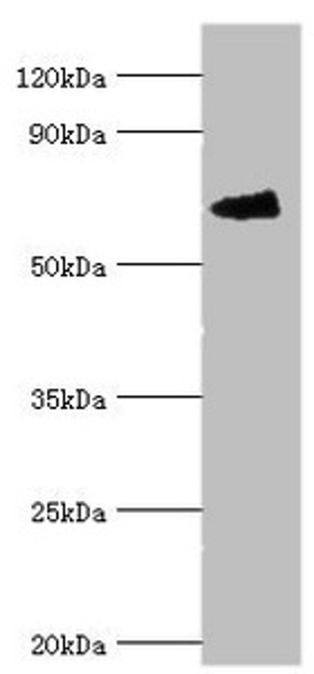 Western blot. All lanes: Fanconi anemia group G protein antibody at 4ug/ml + Mouse gonad tissue. Secondary. Goat polyclonal to rabbit IgG at 1/10000 dilution. Predicted band size: 69 kDa. Observed band size: 69 kDa. 