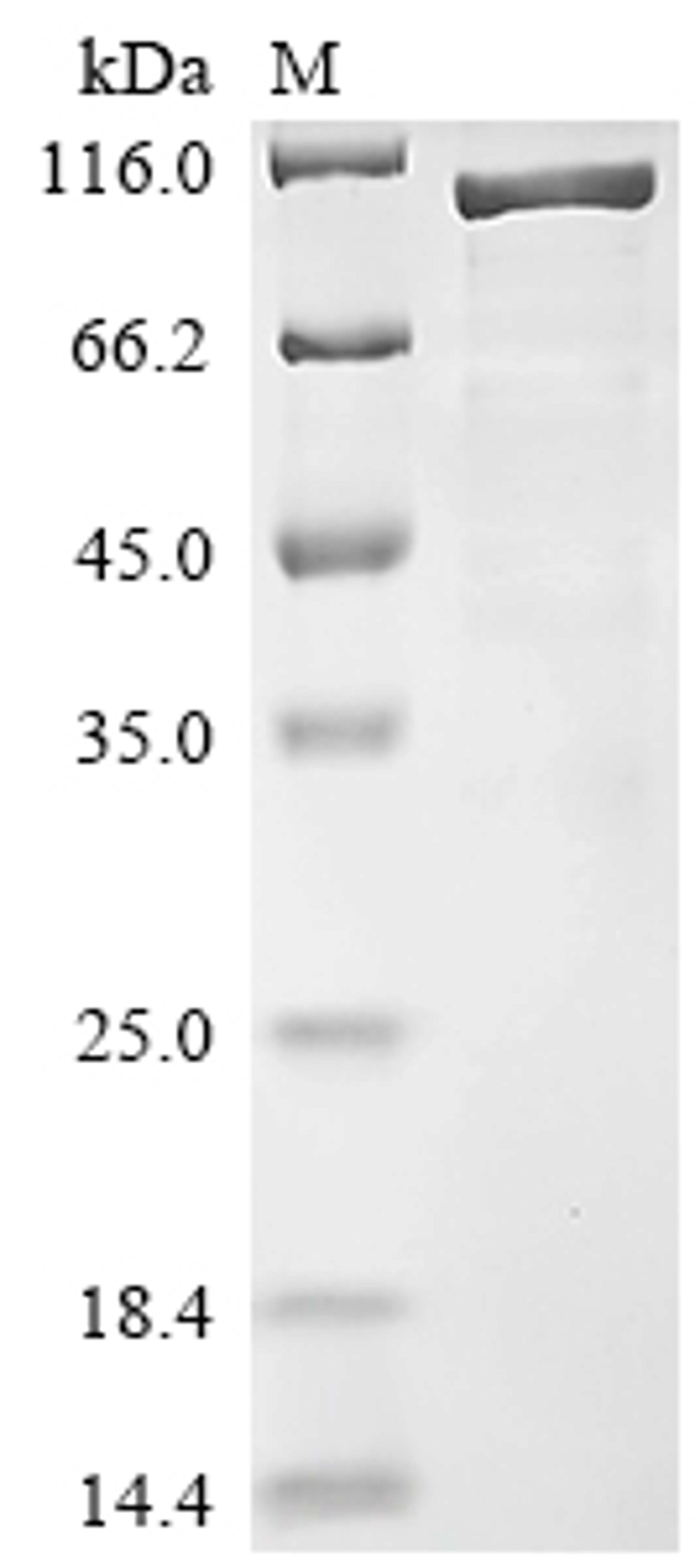 (Tris-Glycine gel) Discontinuous SDS-PAGE (reduced) with 5% enrichment gel and 15% separation gel.