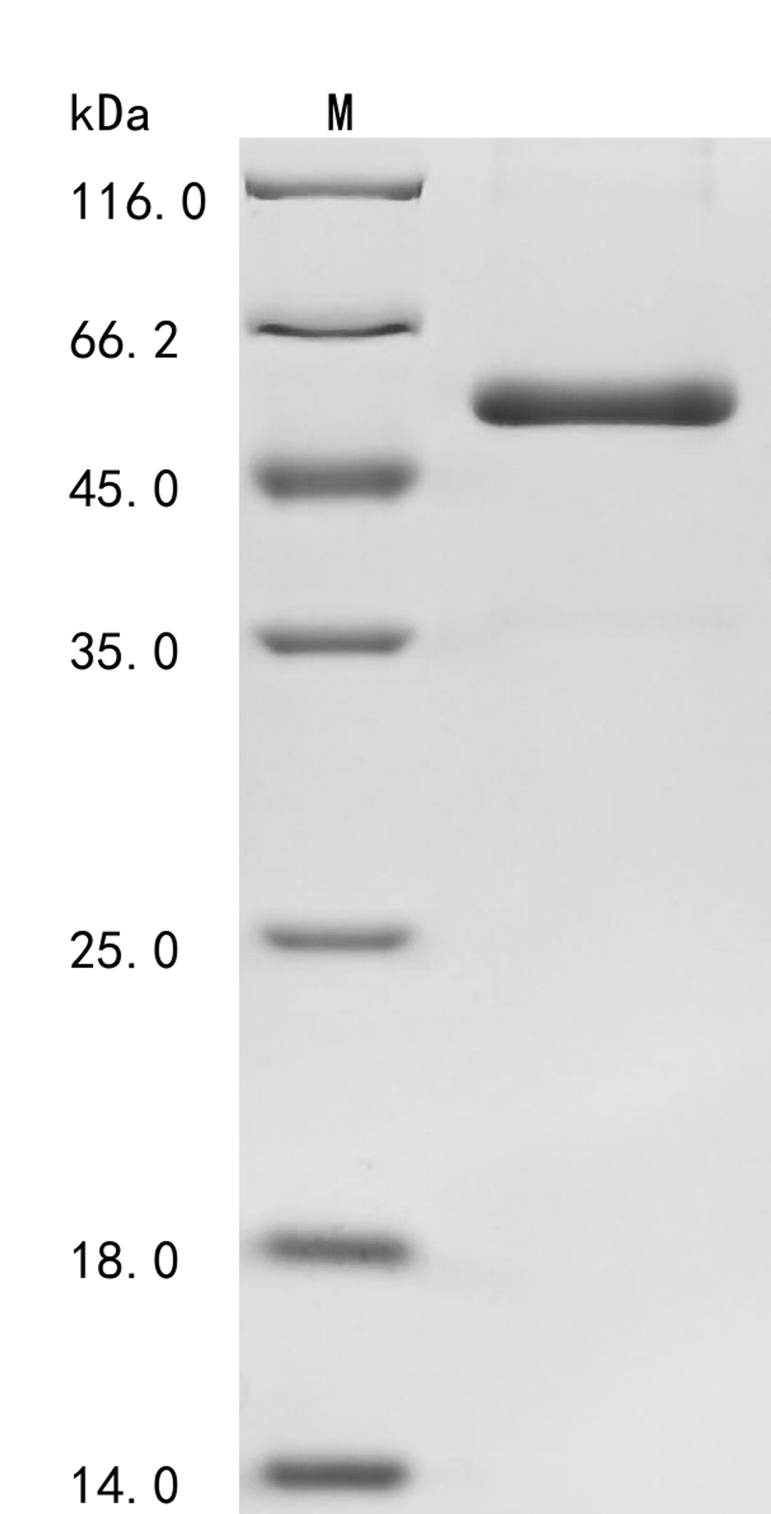 (Tris-Glycine gel) Discontinuous SDS-PAGE (reduced) with 5% enrichment gel and 15% separation gel.