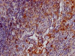 IHC image of CSB-RA567010A0HU diluted at 1:100 and staining in paraffin-embedded human tonsil tissue performed on a Leica BondTM system. After dewaxing and hydration, antigen retrieval was mediated by high pressure in a citrate buffer (pH 6.0). Section was blocked with 10% normal goat serum 30min at RT. Then primary antibody (1% BSA) was incubated at 4℃ overnight. The primary is detected by a Goat anti-rabbit IgG polymer labeled by HRP and visualized using 0.05% DAB.
