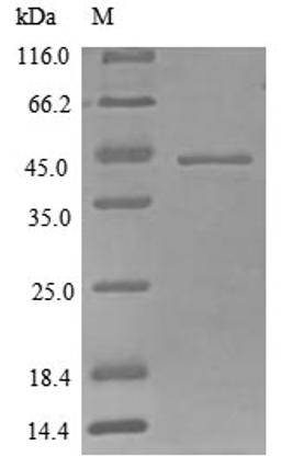 (Tris-Glycine gel) Discontinuous SDS-PAGE (reduced) with 5% enrichment gel and 15% separation gel.