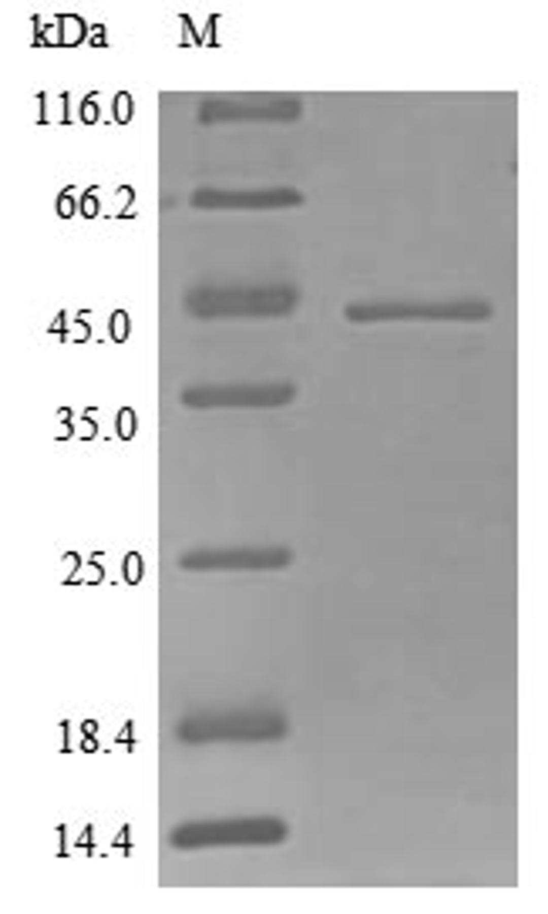 (Tris-Glycine gel) Discontinuous SDS-PAGE (reduced) with 5% enrichment gel and 15% separation gel.