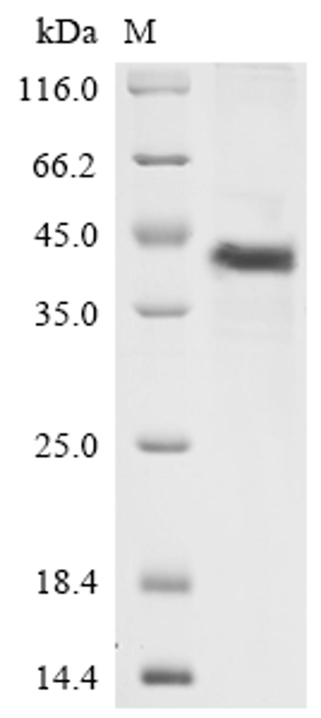 (Tris-Glycine gel) Discontinuous SDS-PAGE (reduced) with 5% enrichment gel and 15% separation gel.