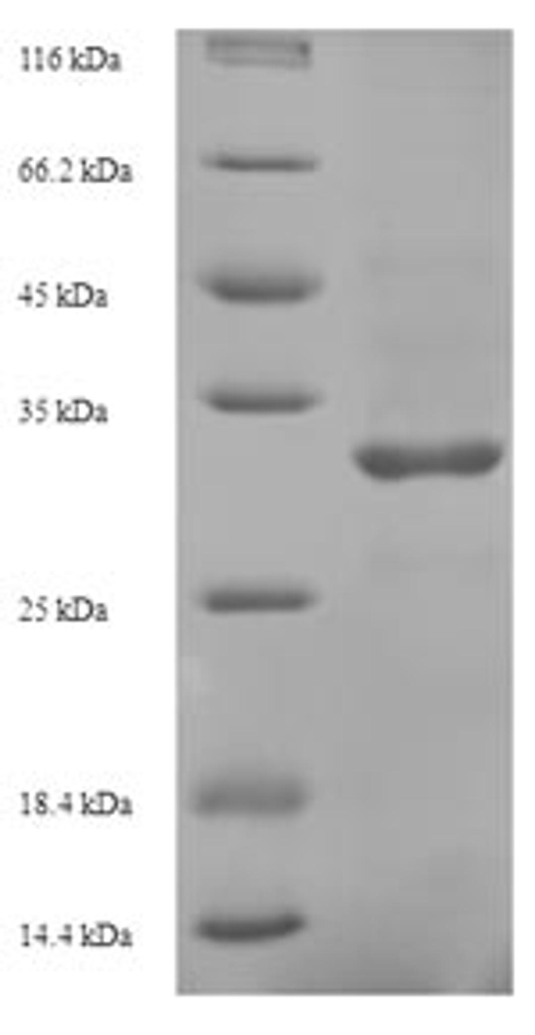 (Tris-Glycine gel) Discontinuous SDS-PAGE (reduced) with 5% enrichment gel and 15% separation gel.