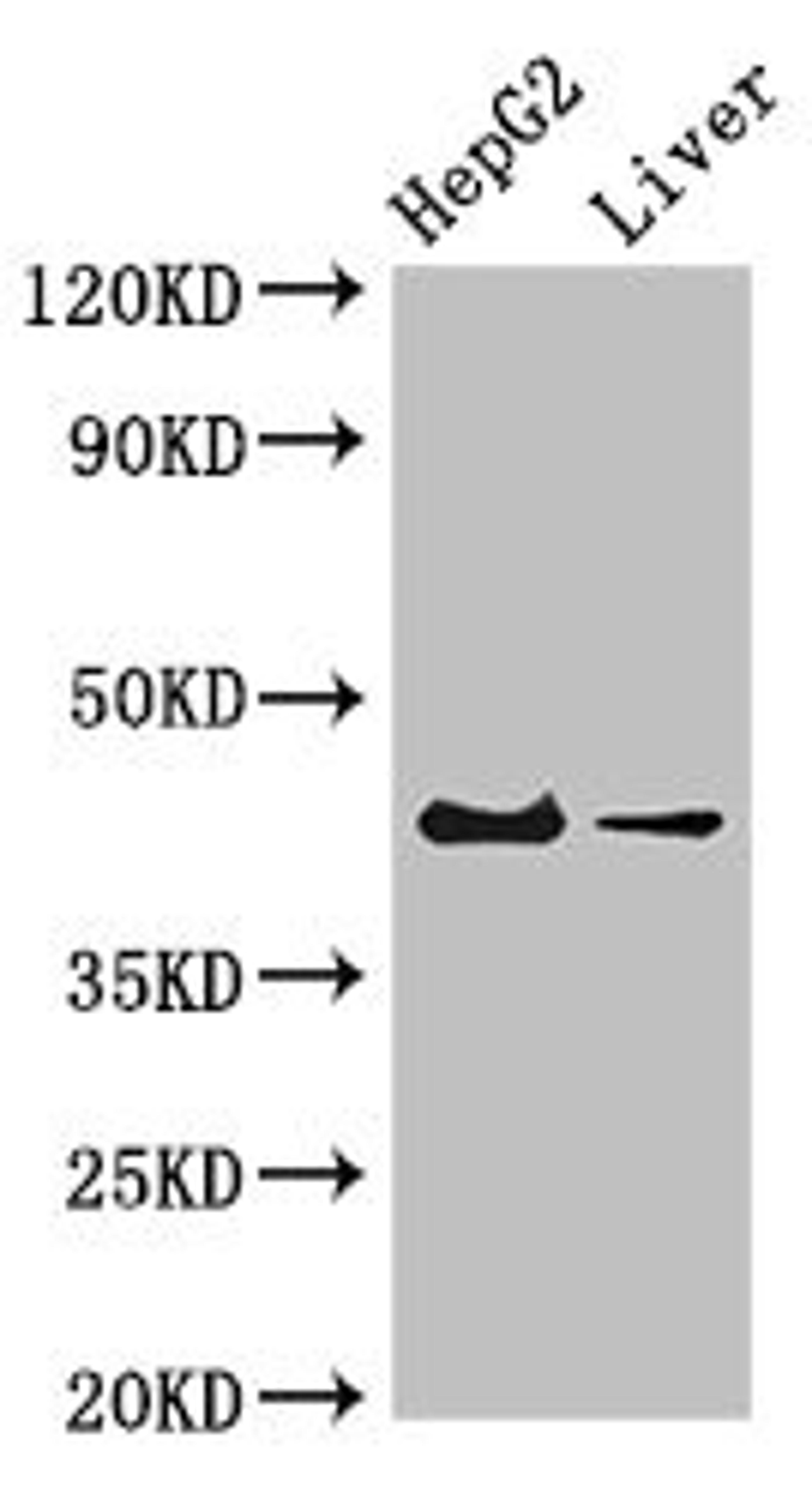 Western Blot. Positive WB detected in: HepG2 whole cell lysate, Mouse liver tissue. All lanes: GPER1 antibody at 4ug/ml. Secondary. Goat polyclonal to rabbit IgG at 1/50000 dilution. Predicted band size: 43 kDa. Observed band size: 43 kDa.