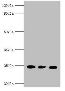Western blot. All lanes: Ras-related protein Rab-5A antibody at 5ug/ml. Lane 1: Mouse brain tissue. Lane 2: HL60 whole cell lysate. Lane 3: Hela whole cell lysate. Secondary. Goat polyclonal to rabbit IgG at 1/10000 dilution. Predicted band size: 24, 23 kDa. Observed band size: 24 kDa. 