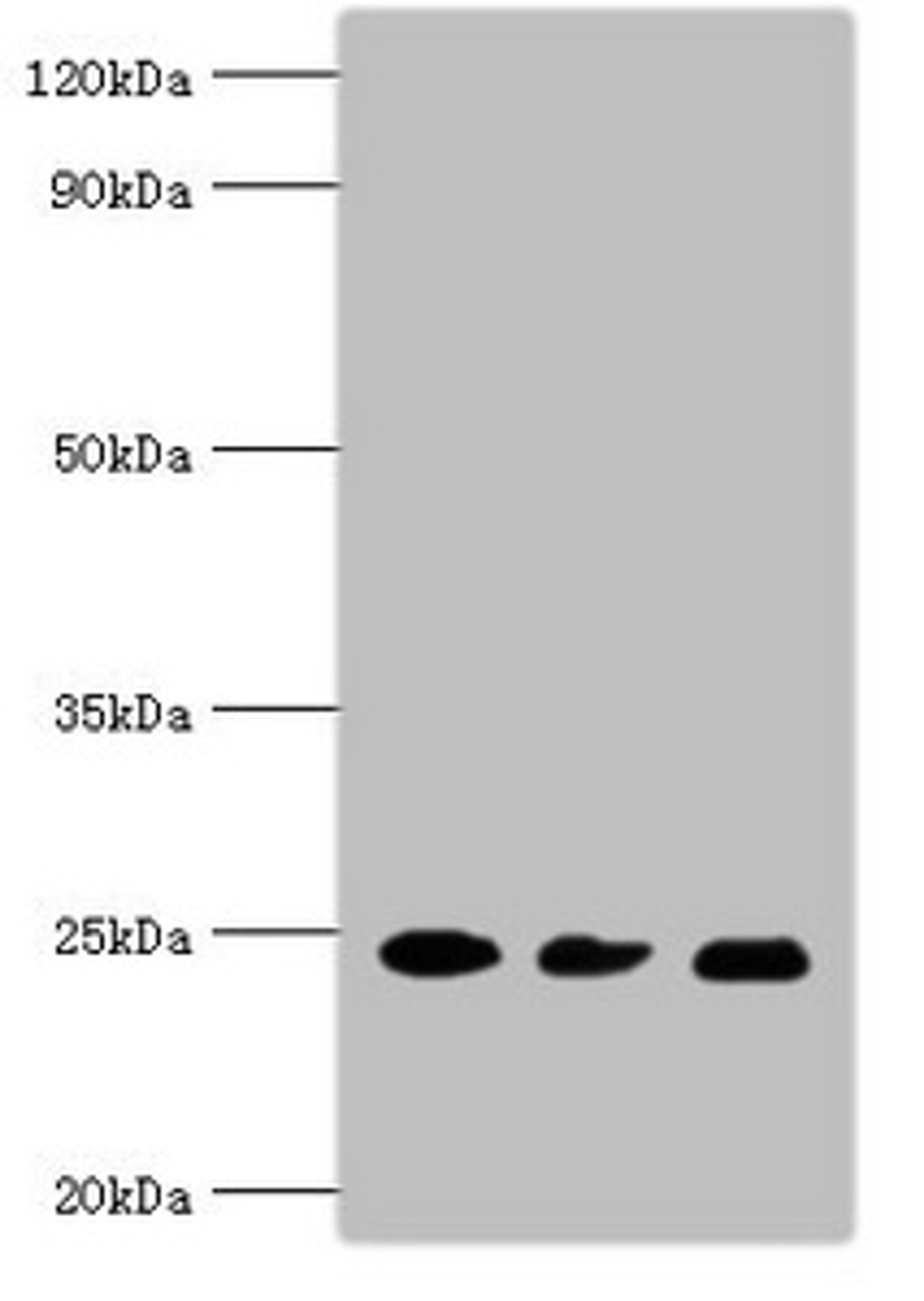 Western blot. All lanes: Ras-related protein Rab-5A antibody at 5ug/ml. Lane 1: Mouse brain tissue. Lane 2: HL60 whole cell lysate. Lane 3: Hela whole cell lysate. Secondary. Goat polyclonal to rabbit IgG at 1/10000 dilution. Predicted band size: 24, 23 kDa. Observed band size: 24 kDa. 